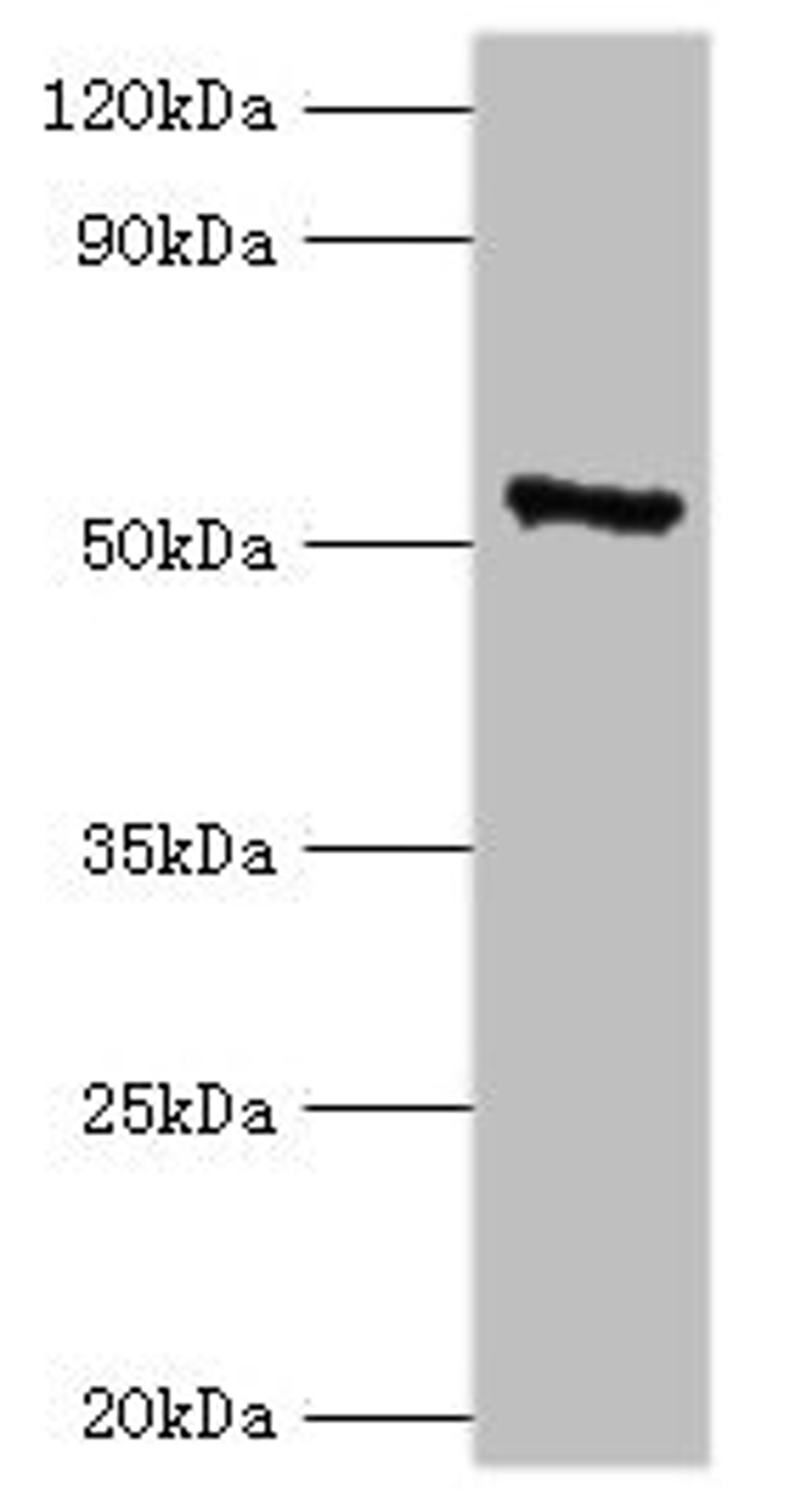 Western blot. All lanes: CAMK4 antibody at 2µg/ml + 293T whole cell lysate. Secondary. Goat polyclonal to rabbit IgG at 1/10000 dilution. Predicted band size: 52 kDa. Observed band size: 52 kDa