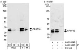 Detection of human and mouse CPSF30 by western blot (h&m) and immunoprecipitation (h).