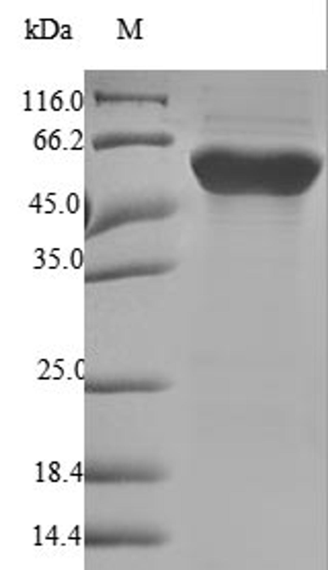 (Tris-Glycine gel) Discontinuous SDS-PAGE (reduced) with 5% enrichment gel and 15% separation gel.