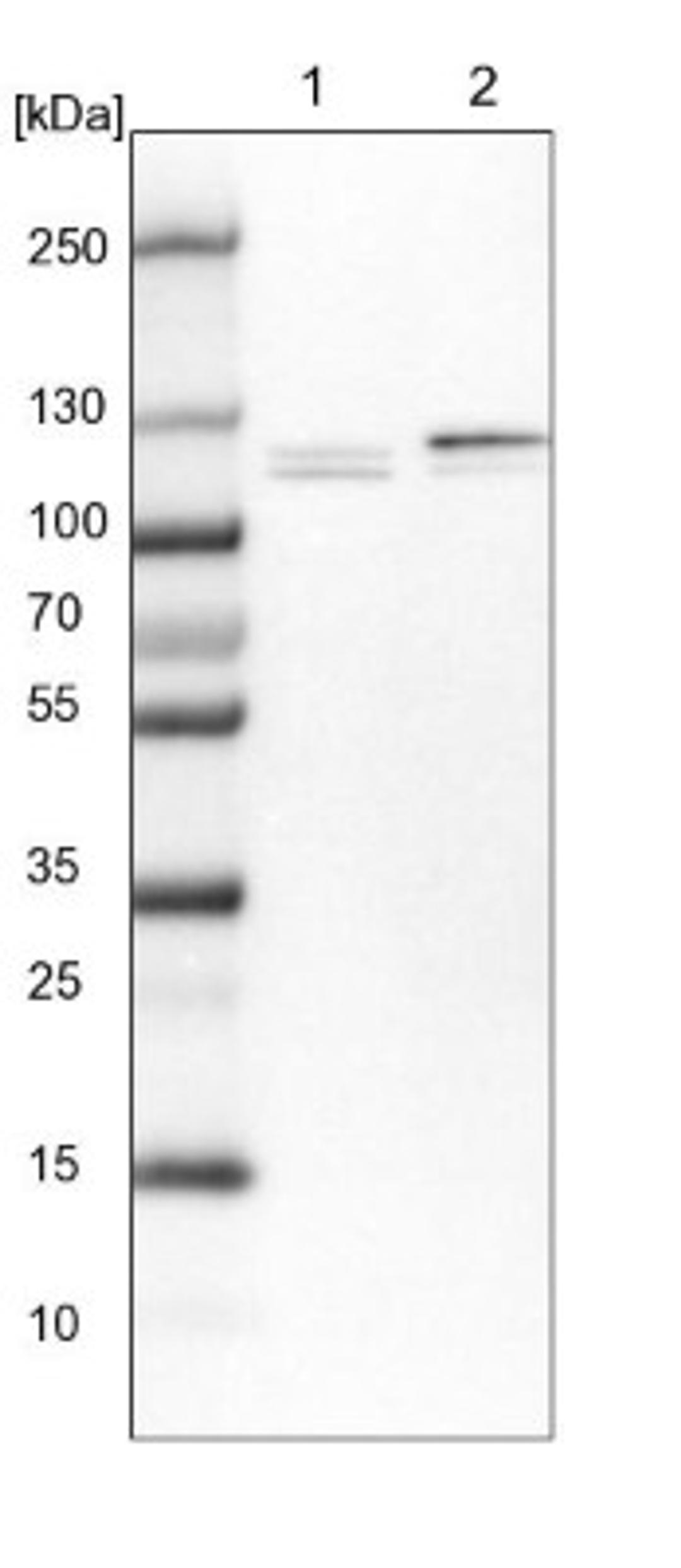 Western Blot: RBM12 Antibody [NBP2-13207] - Lane 1: NIH-3T3 cell lysate (Mouse embryonic fibroblast cells)<br/>Lane 2: NBT-II cell lysate (Rat Wistar bladder tumour cells)