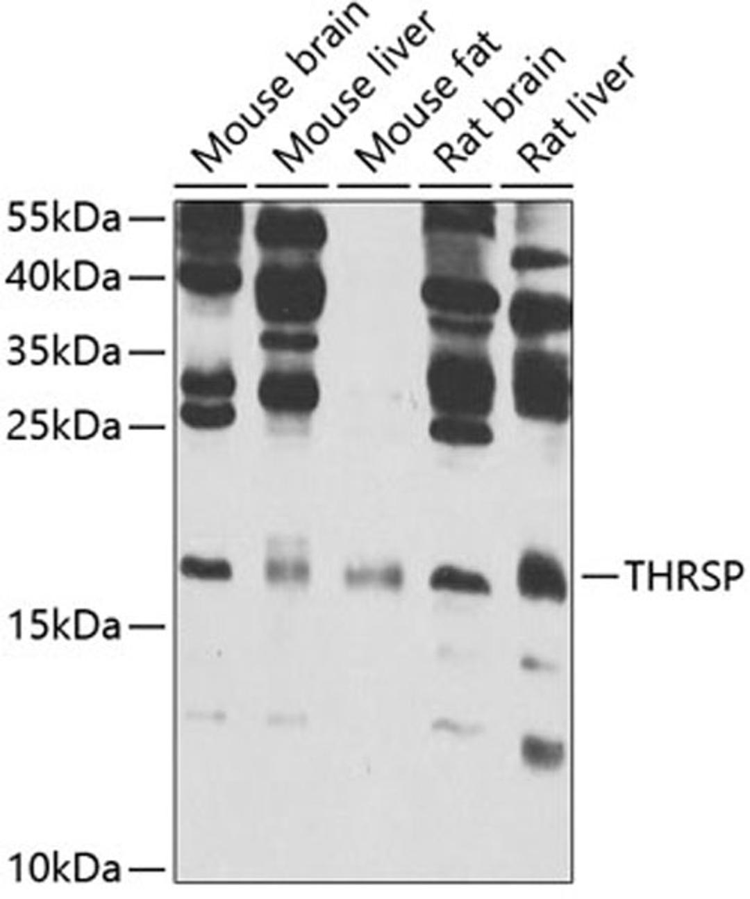 Western blot - THRSP antibody (A7232)