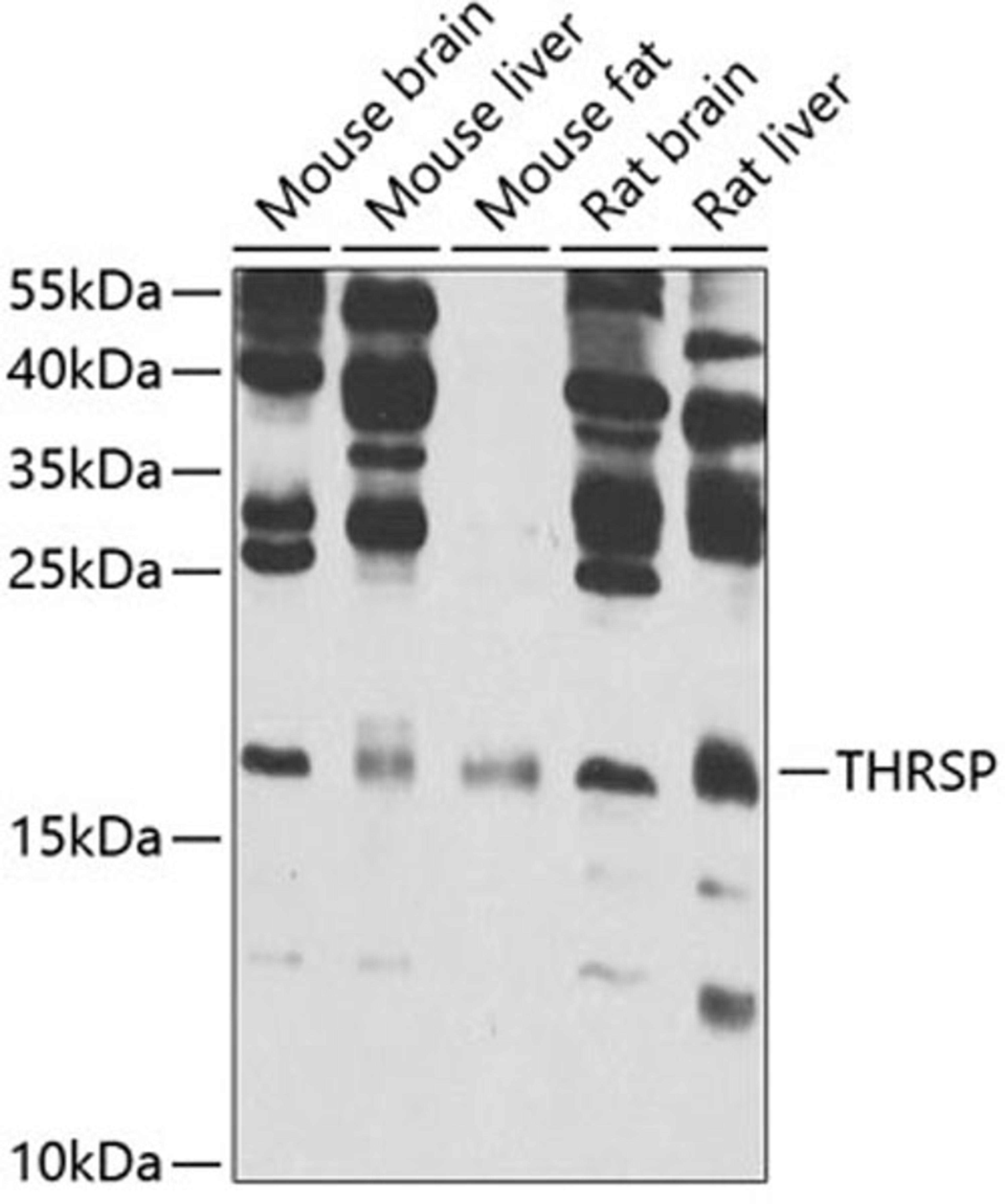 Western blot - THRSP antibody (A7232)