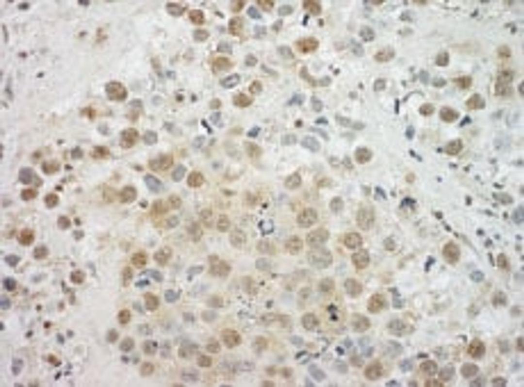 Detection of human EYA4 by immunohistochemistry.