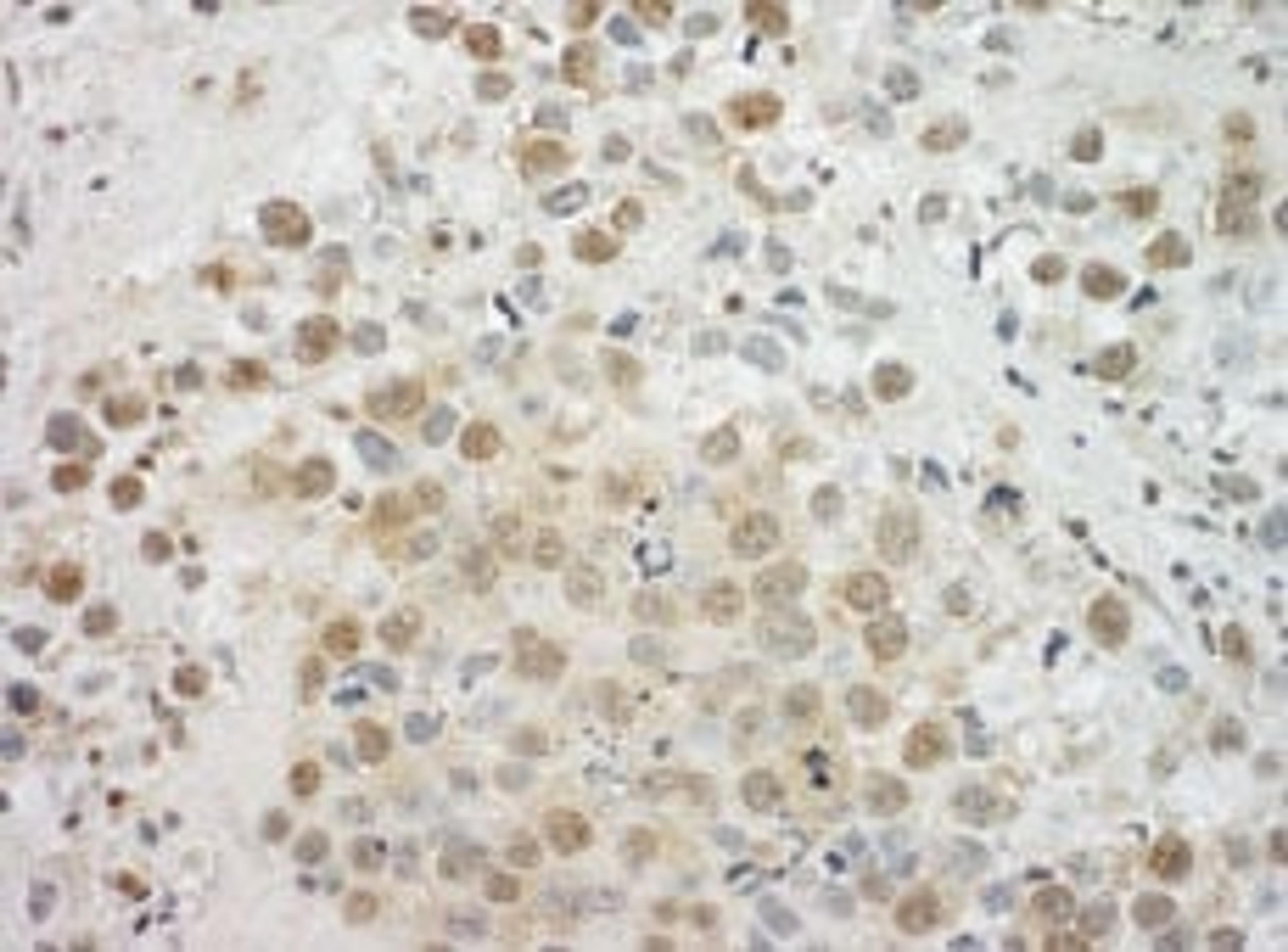 Detection of human EYA4 by immunohistochemistry.