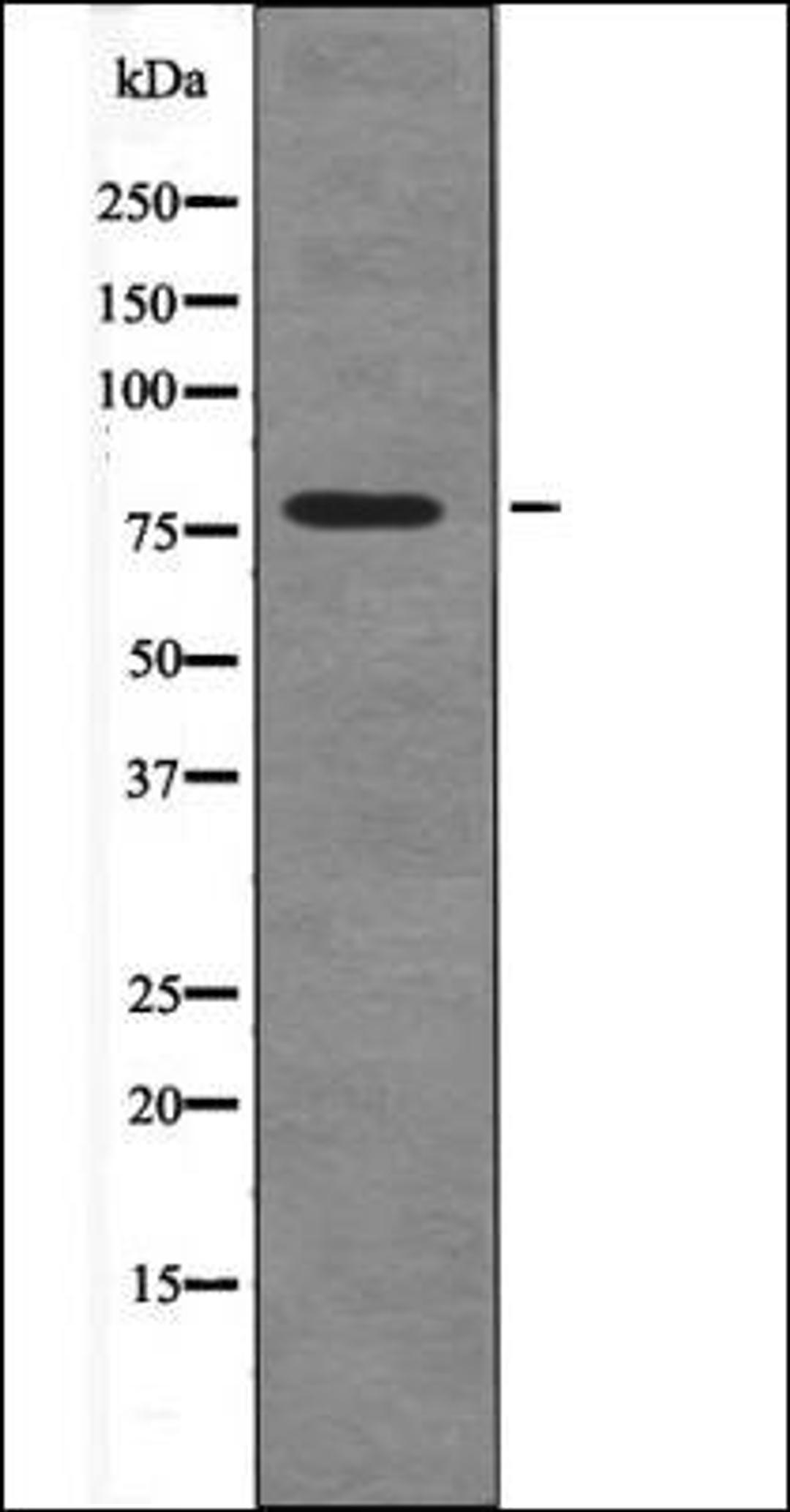 Western blot analysis of Na2VO3 treated HepG2 whole cell lysates using Caldesmon -Phospho-Ser759- antibody