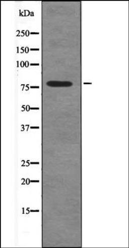 Western blot analysis of Na2VO3 treated HepG2 whole cell lysates using Caldesmon -Phospho-Ser759- antibody