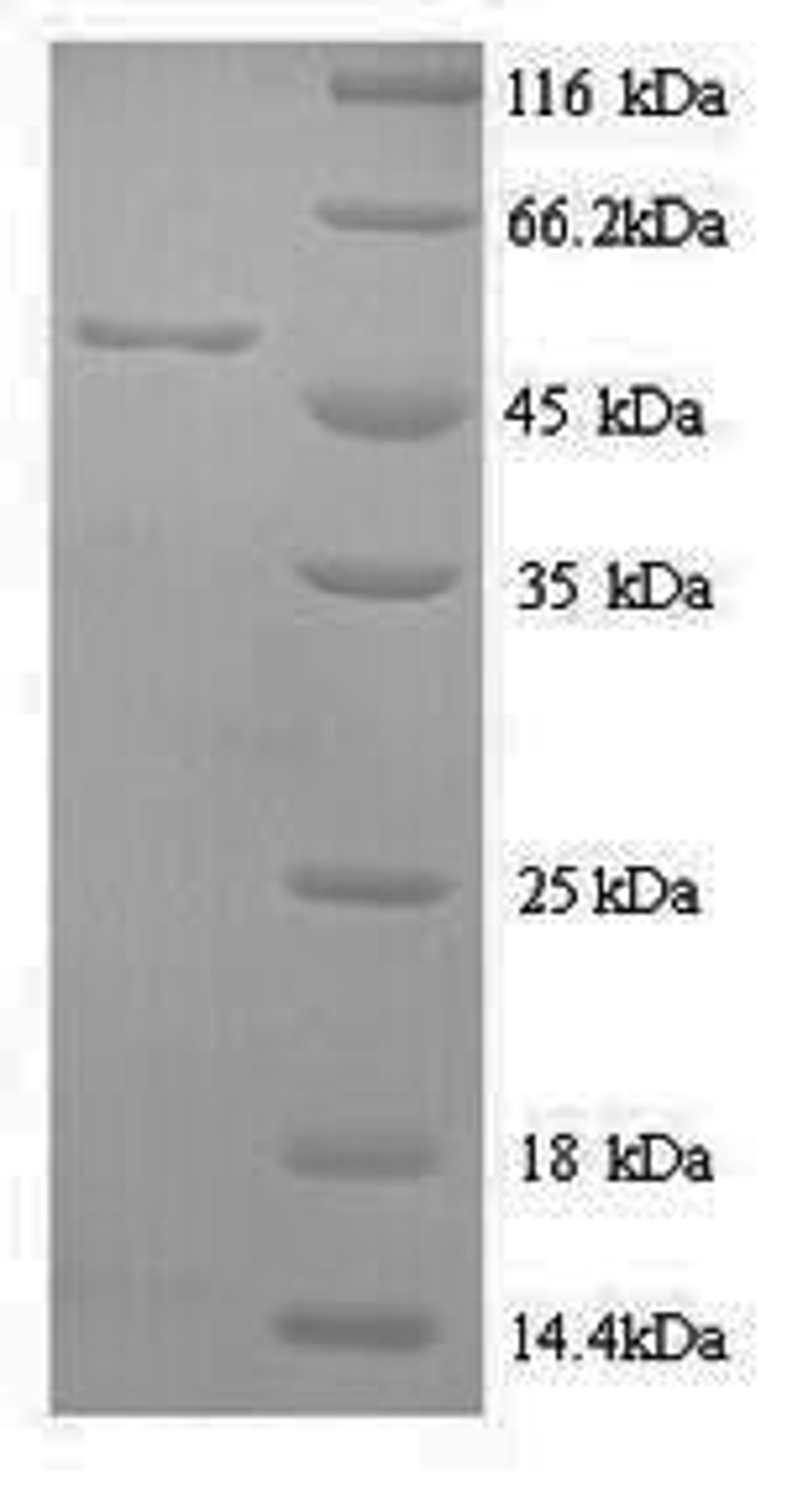 (Tris-Glycine gel) Discontinuous SDS-PAGE (reduced) with 5% enrichment gel and 15% separation gel.