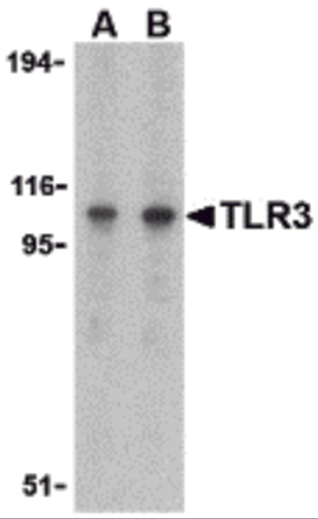 Western blot analysis of TLR3 in Daudi cell lysate with TLR3 antibody at (A) 1 and (B) 2 μg/mL.