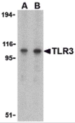 Western blot analysis of TLR3 in Daudi cell lysate with TLR3 antibody at (A) 1 and (B) 2 μg/mL.