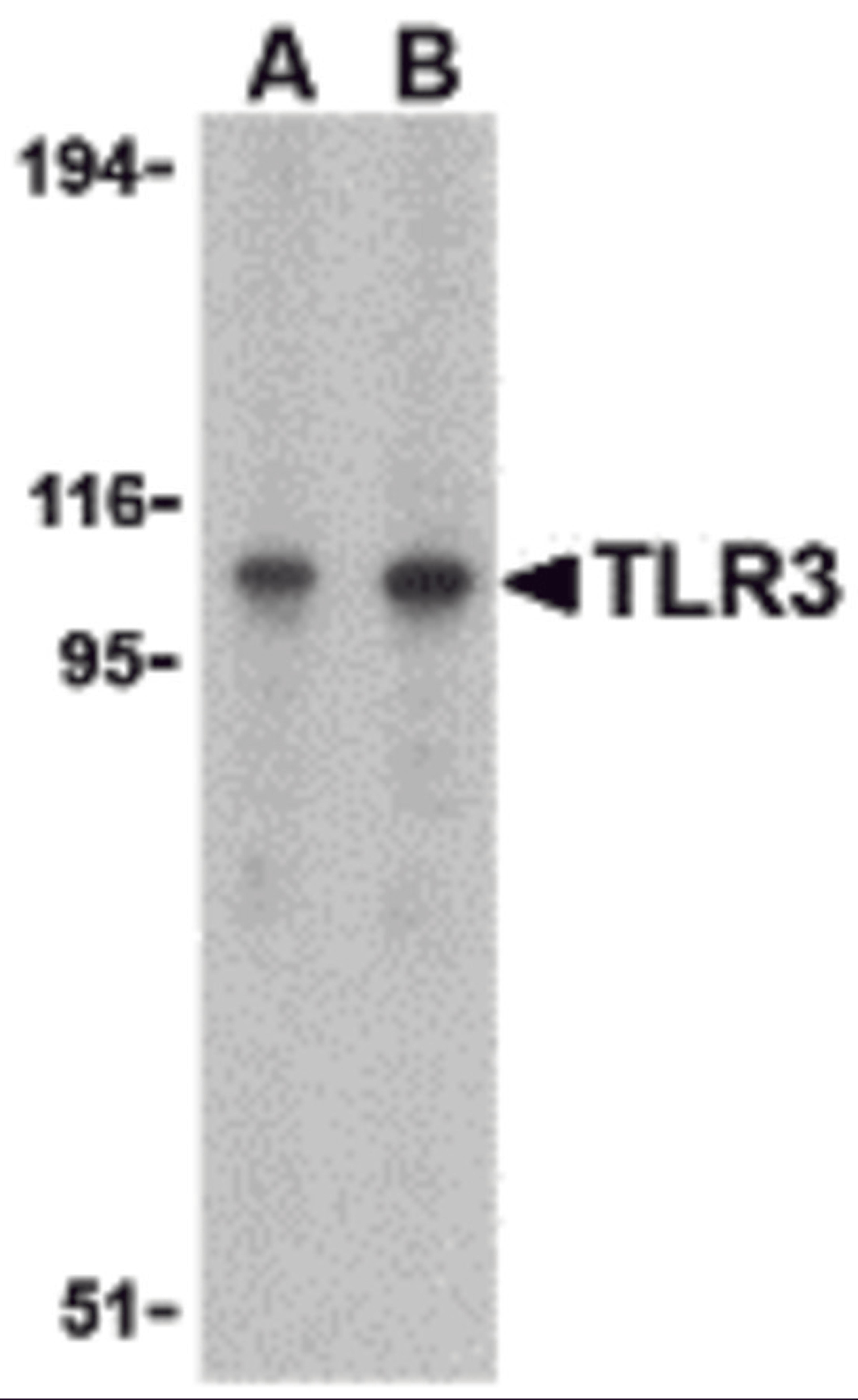 Western blot analysis of TLR3 in Daudi cell lysate with TLR3 antibody at (A) 1 and (B) 2 μg/mL.