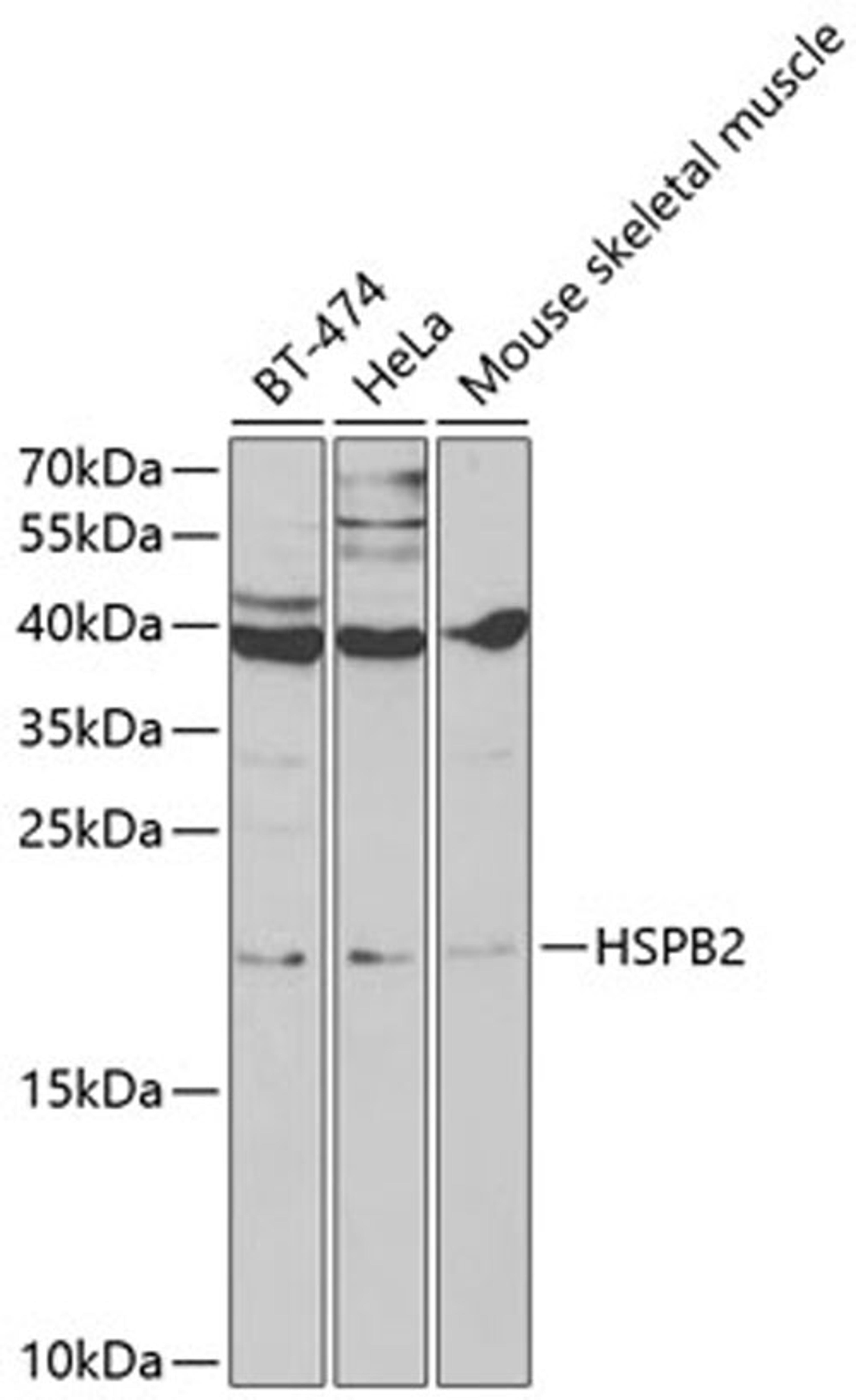 Western blot - HSPB2 antibody (A2350)