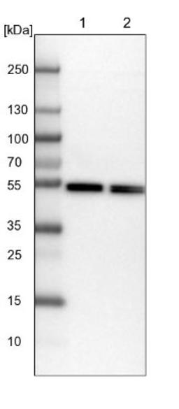 Western Blot: Dynactin Subunit 2/DCTN2/DCTN-50 Antibody [NBP1-85277] - Lane 1: NIH-3T3 cell lysate (Mouse embryonic fibroblast cells)<br/>Lane 2: NBT-II cell lysate (Rat Wistar bladder tumour cells)