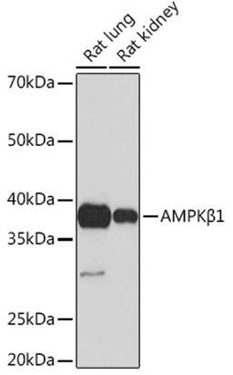 Western blot - AMPKß1 Rabbit mAb (A4344)