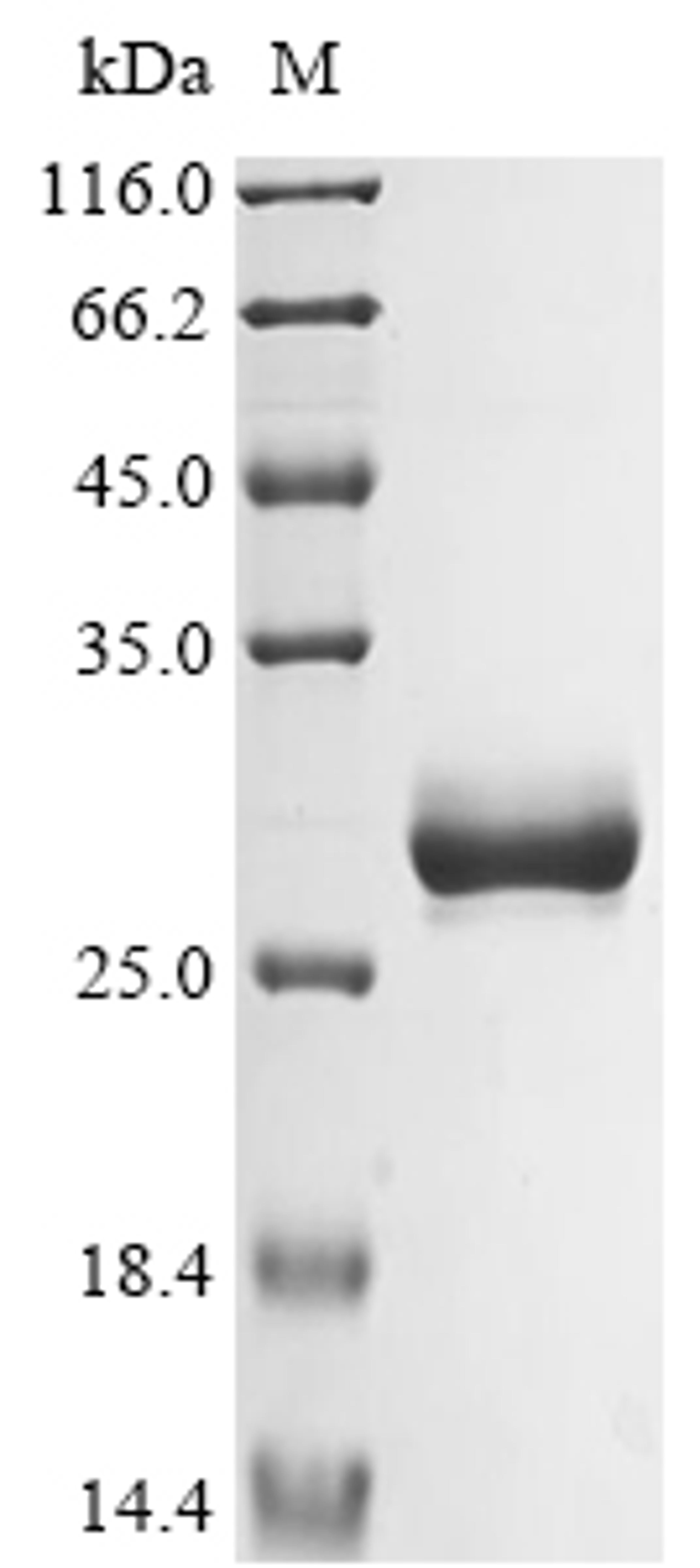(Tris-Glycine gel) Discontinuous SDS-PAGE (reduced) with 5% enrichment gel and 15% separation gel.