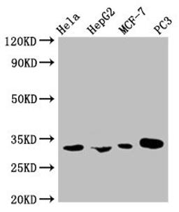 Western Blot. Positive WB detected in: Hela whole cell lysate, HepG2 whole cell lysate, MCF-7 whole cell lysate, PC-3 whole cell lysate. All lanes: AGBL2 antibody at 1:1000. Secondary. Goat polyclonal to mouse IgG at 1/50000 dilution. Predicted band size: 32, 49, 104 KDa. Observed band size: 32 KDa. Exposure time：5min