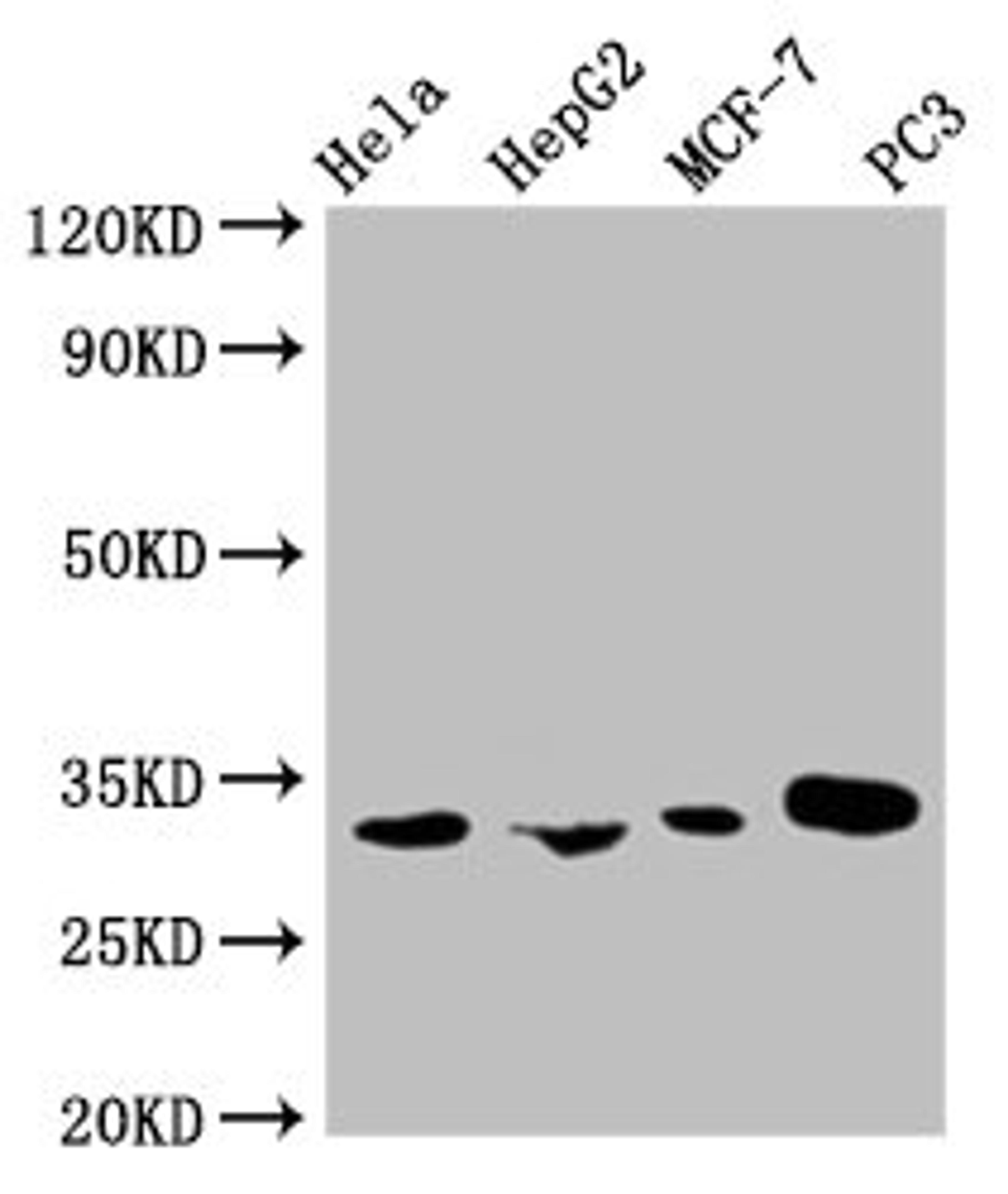 Western Blot. Positive WB detected in: Hela whole cell lysate, HepG2 whole cell lysate, MCF-7 whole cell lysate, PC-3 whole cell lysate. All lanes: AGBL2 antibody at 1:1000. Secondary. Goat polyclonal to mouse IgG at 1/50000 dilution. Predicted band size: 32, 49, 104 KDa. Observed band size: 32 KDa. Exposure time：5min