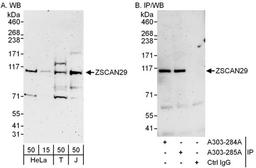 Detection of human ZSCAN29 by WB and IP.