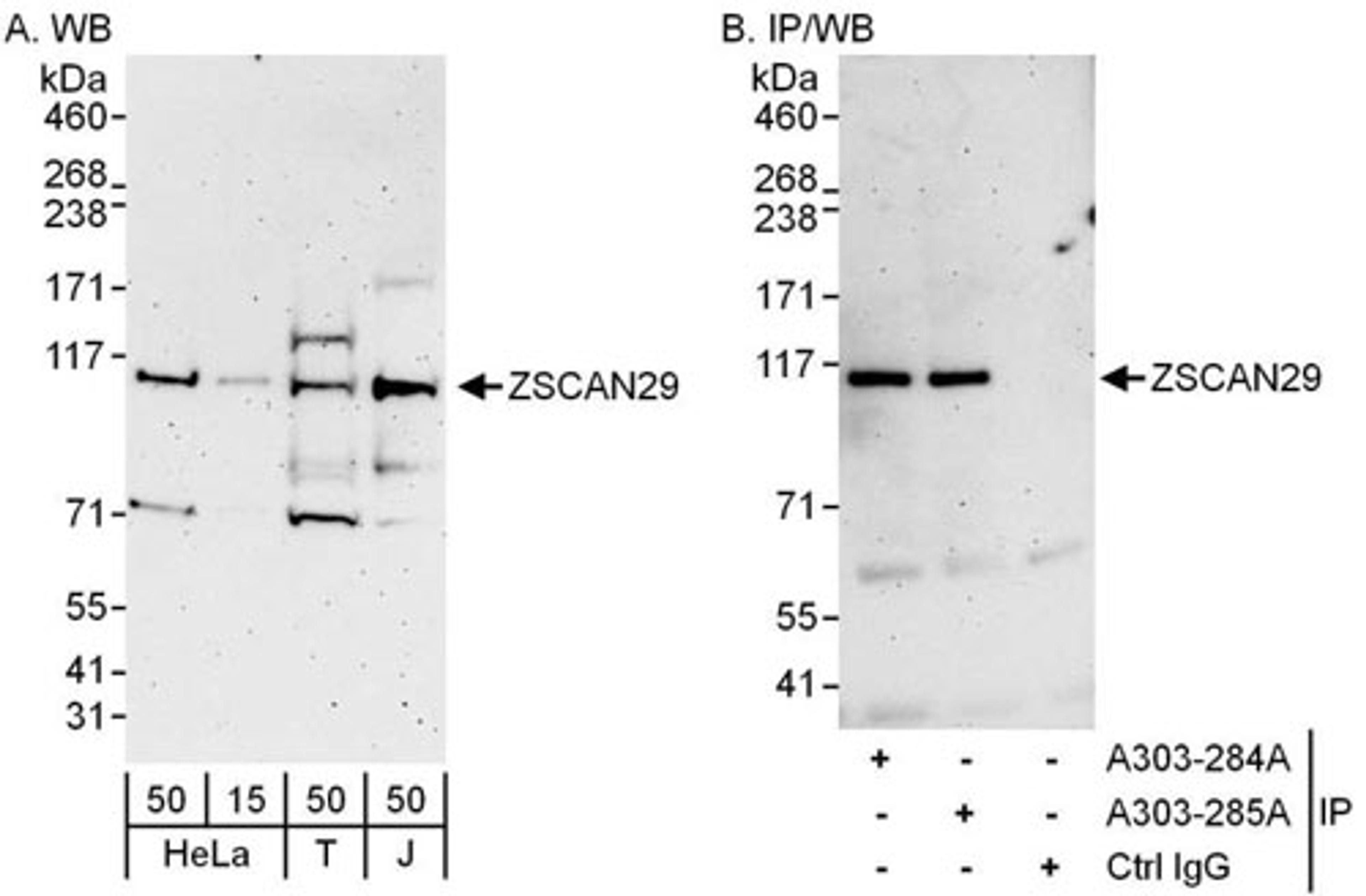 Detection of human ZSCAN29 by WB and IP.