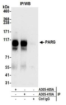 Detection of human PARG by western blot of immunoprecipitates.