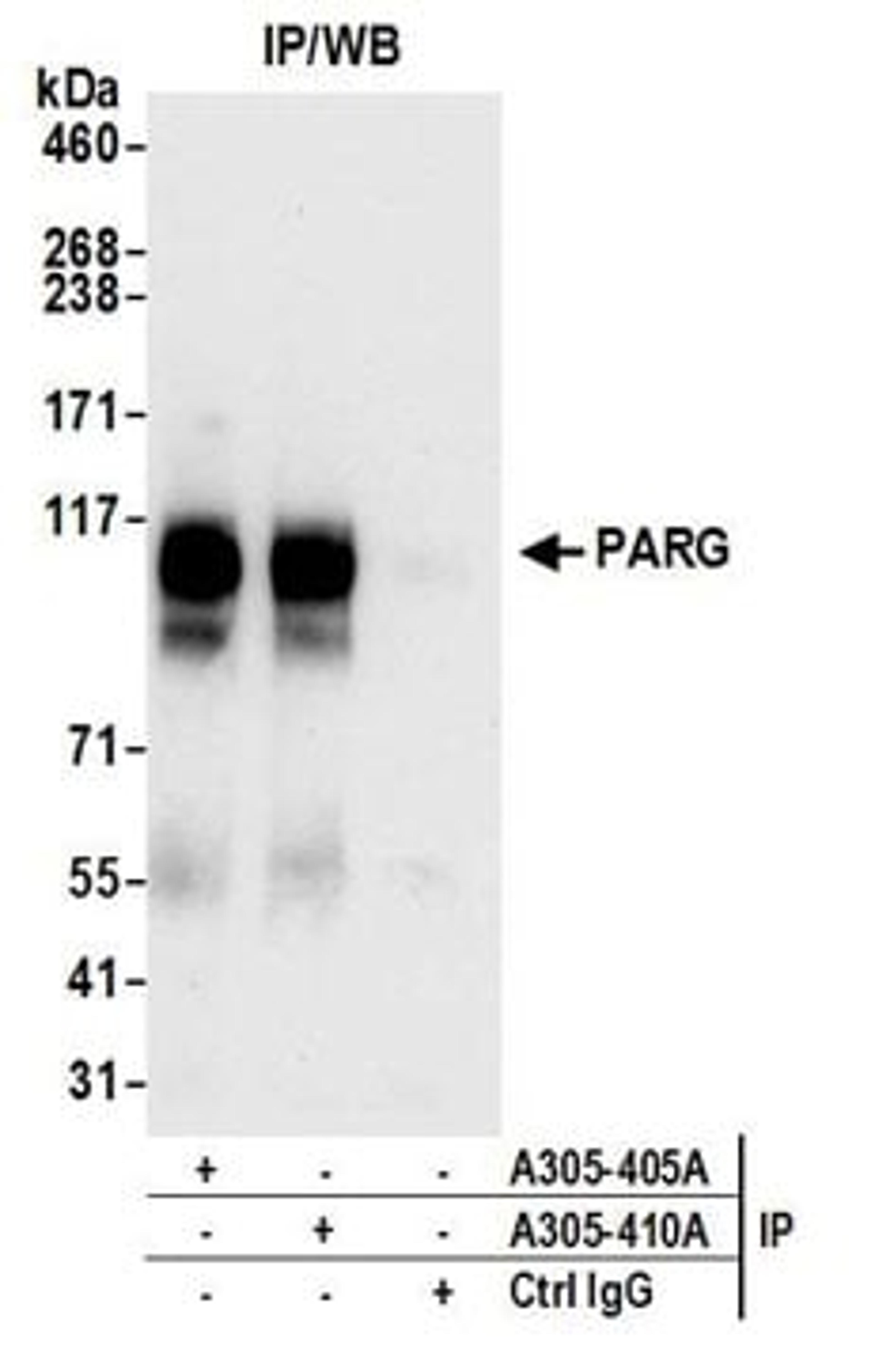 Detection of human PARG by western blot of immunoprecipitates.