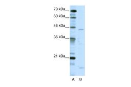 Antibody used in WB on Human HepG2 at 5.0 ug/ml.