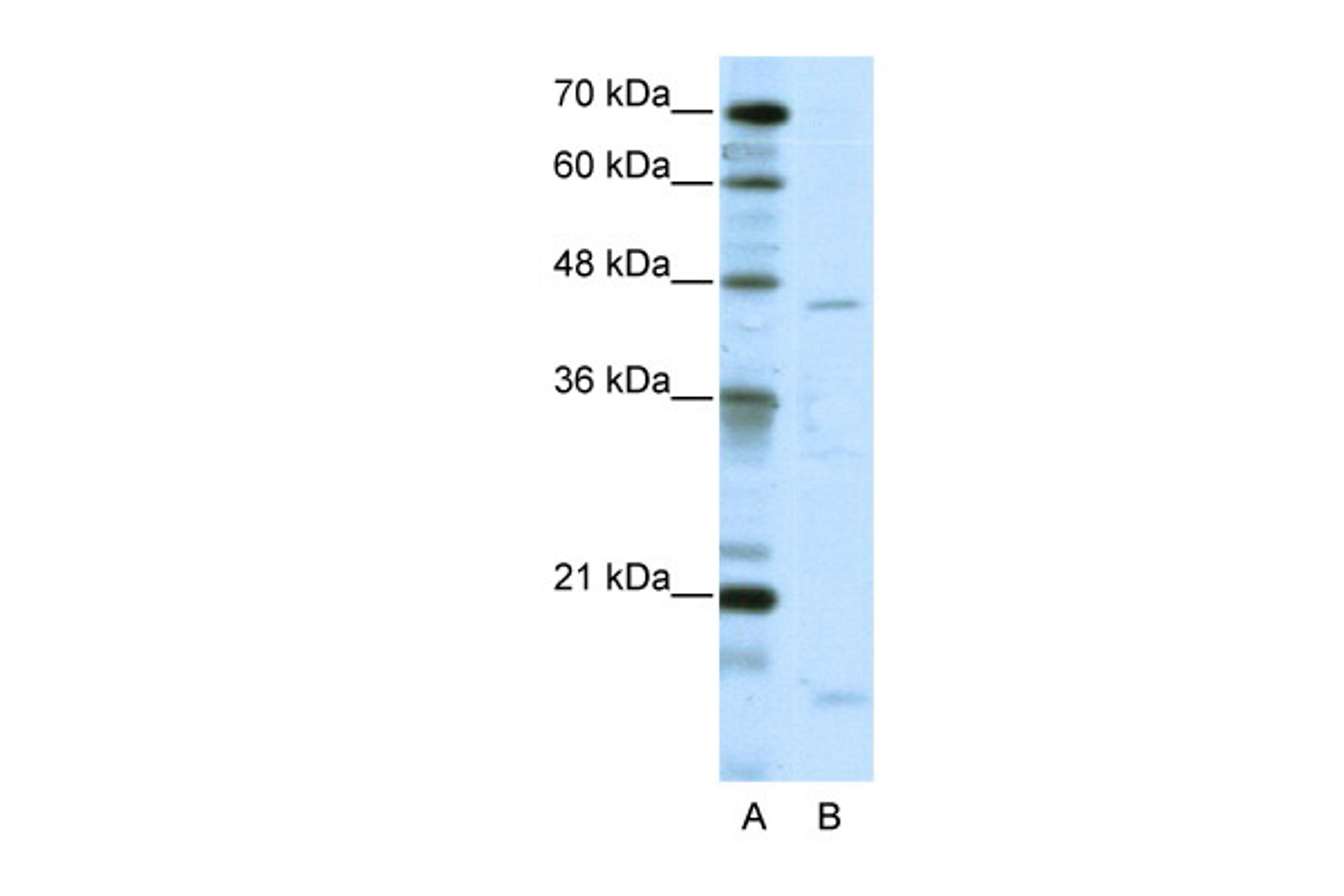 Antibody used in WB on Human HepG2 at 5.0 ug/ml.