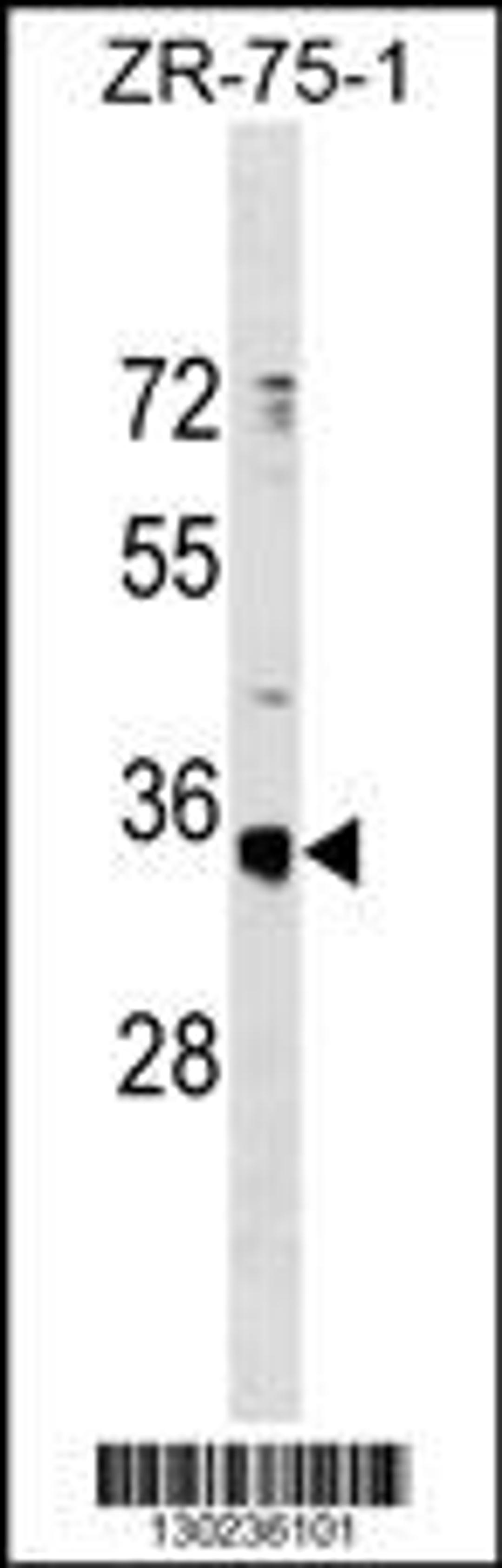 Western blot analysis in ZR-75-1 cell line lysates (35ug/lane).