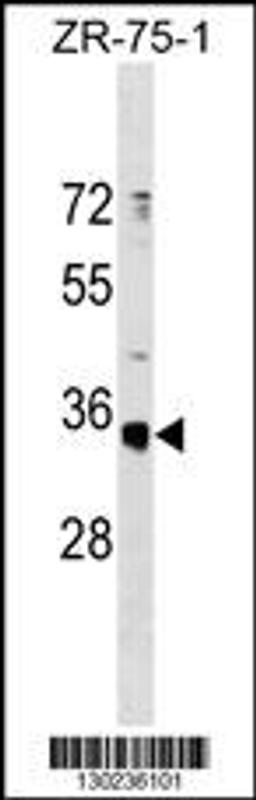 Western blot analysis in ZR-75-1 cell line lysates (35ug/lane).