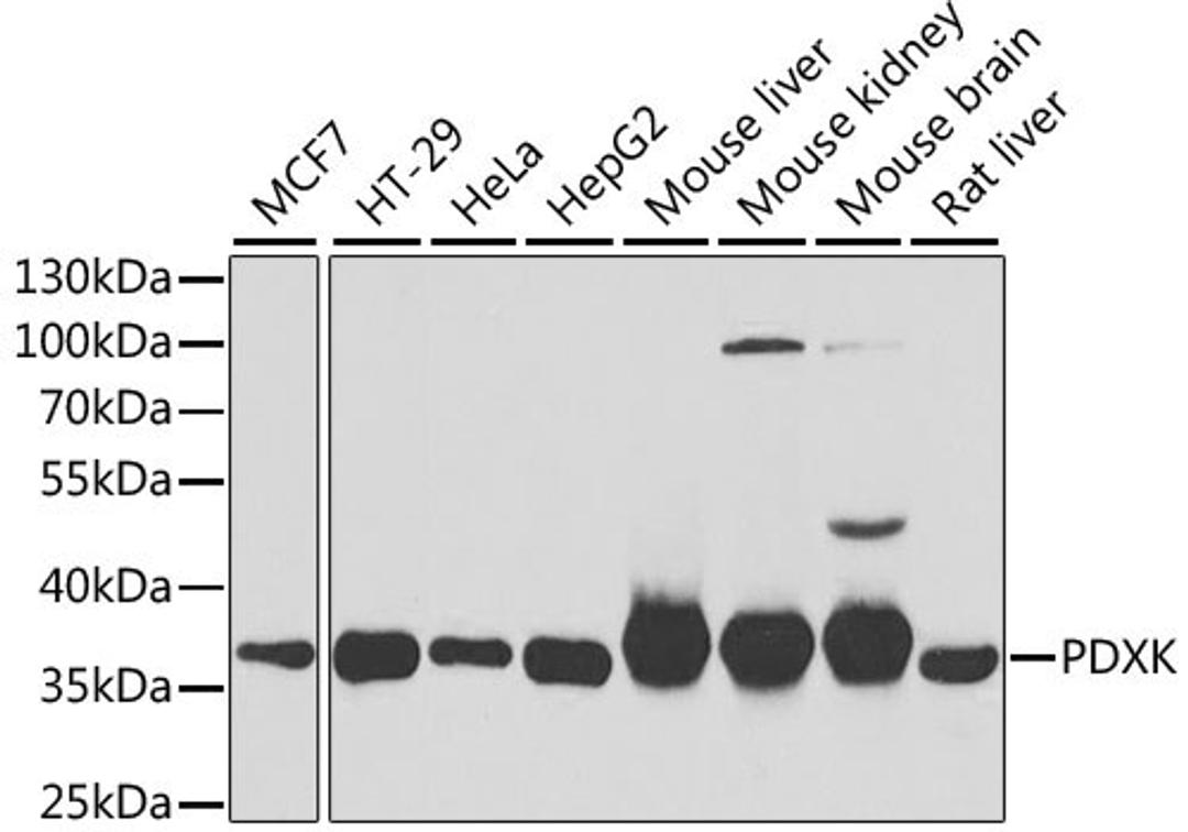 Western blot - PDXK antibody (A6687)