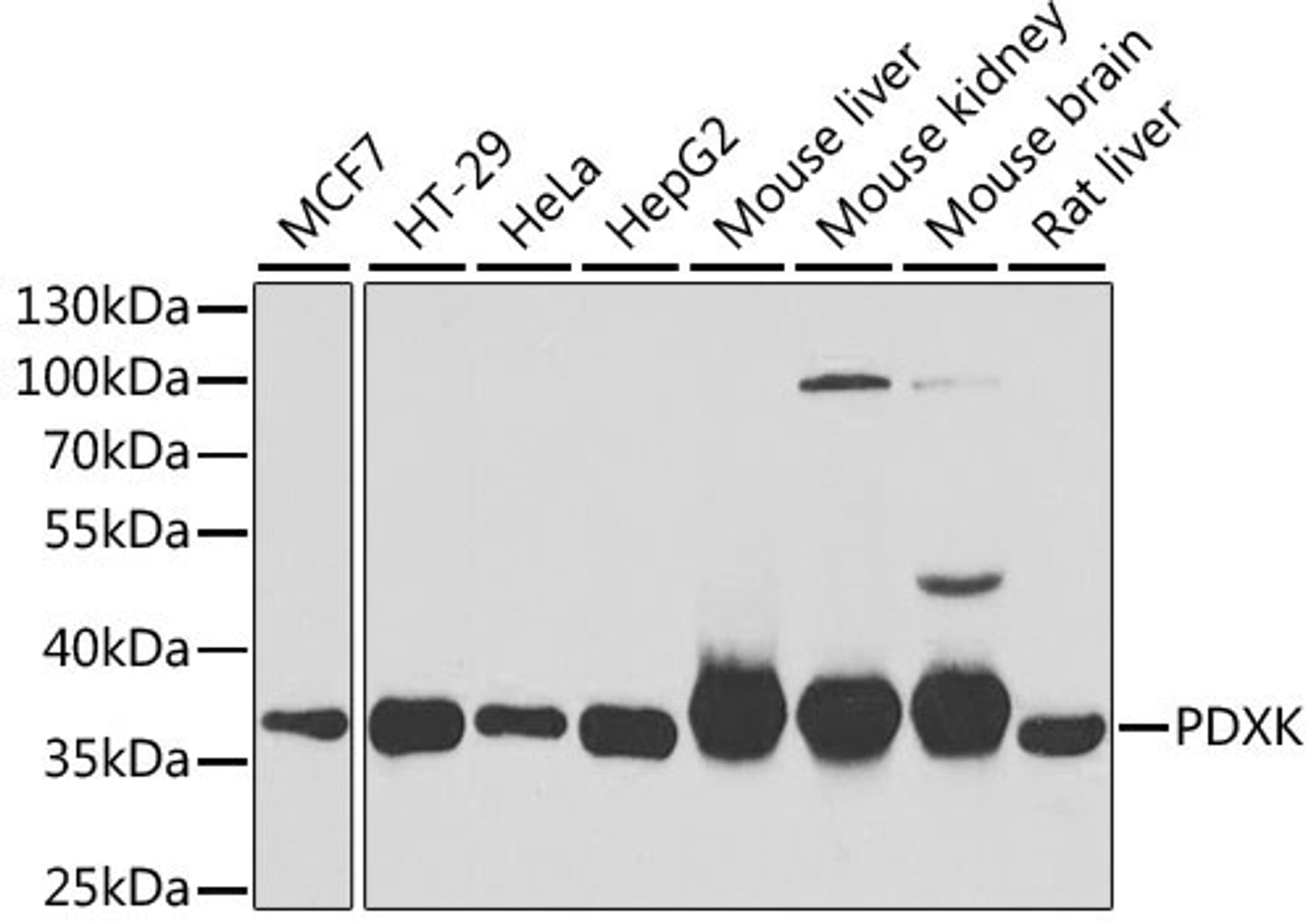 Western blot - PDXK antibody (A6687)