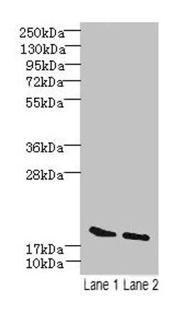 Western blot. All lanes: SKP1 antibody at 15µg/ml. Lane 1: Mouse brain tissue. Lane 2: Hela whole cell lysate. Secondary. Goat polyclonal to rabbit IgG at 1/10000 dilution. Predicted band size: 19 kDa. Observed band size: 19 kDa