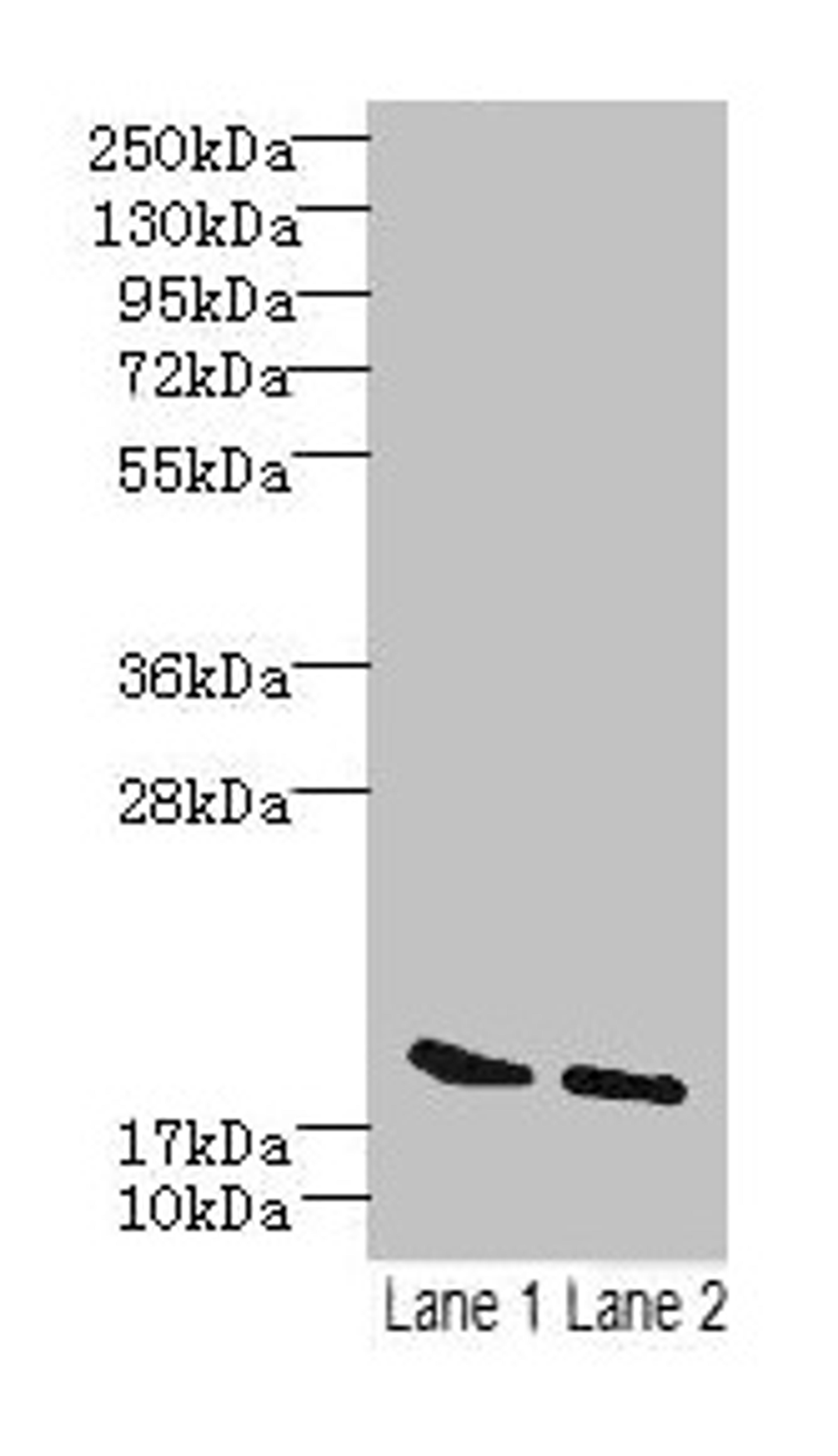 Western blot. All lanes: SKP1 antibody at 15µg/ml. Lane 1: Mouse brain tissue. Lane 2: Hela whole cell lysate. Secondary. Goat polyclonal to rabbit IgG at 1/10000 dilution. Predicted band size: 19 kDa. Observed band size: 19 kDa