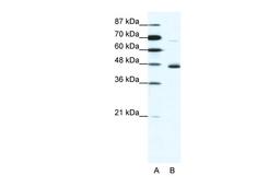 Antibody used in WB on Human Jurkat 1.25 ug/ml.