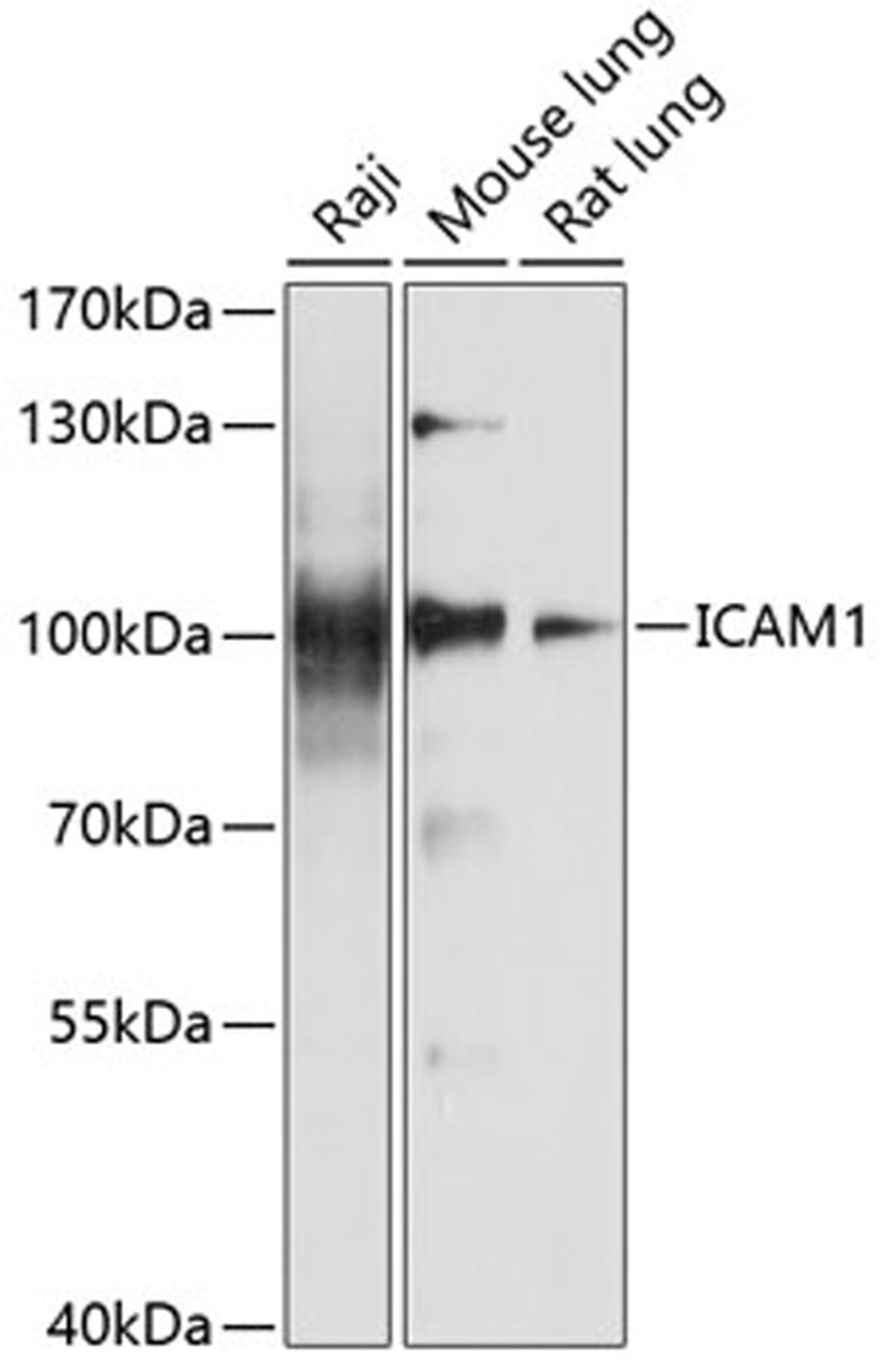 Western blot - ICAM1 antibody (A5597)