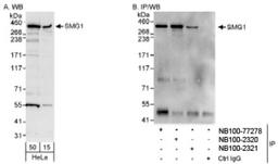 Western Blot: SMG1 Antibody [NB100-77278] - HeLa whole cell lysate using NB100-77278. SMG1 was also immunoprecipitated by rabbit anti-SMG1 antibodies NB100-2320 and NB100-2321.