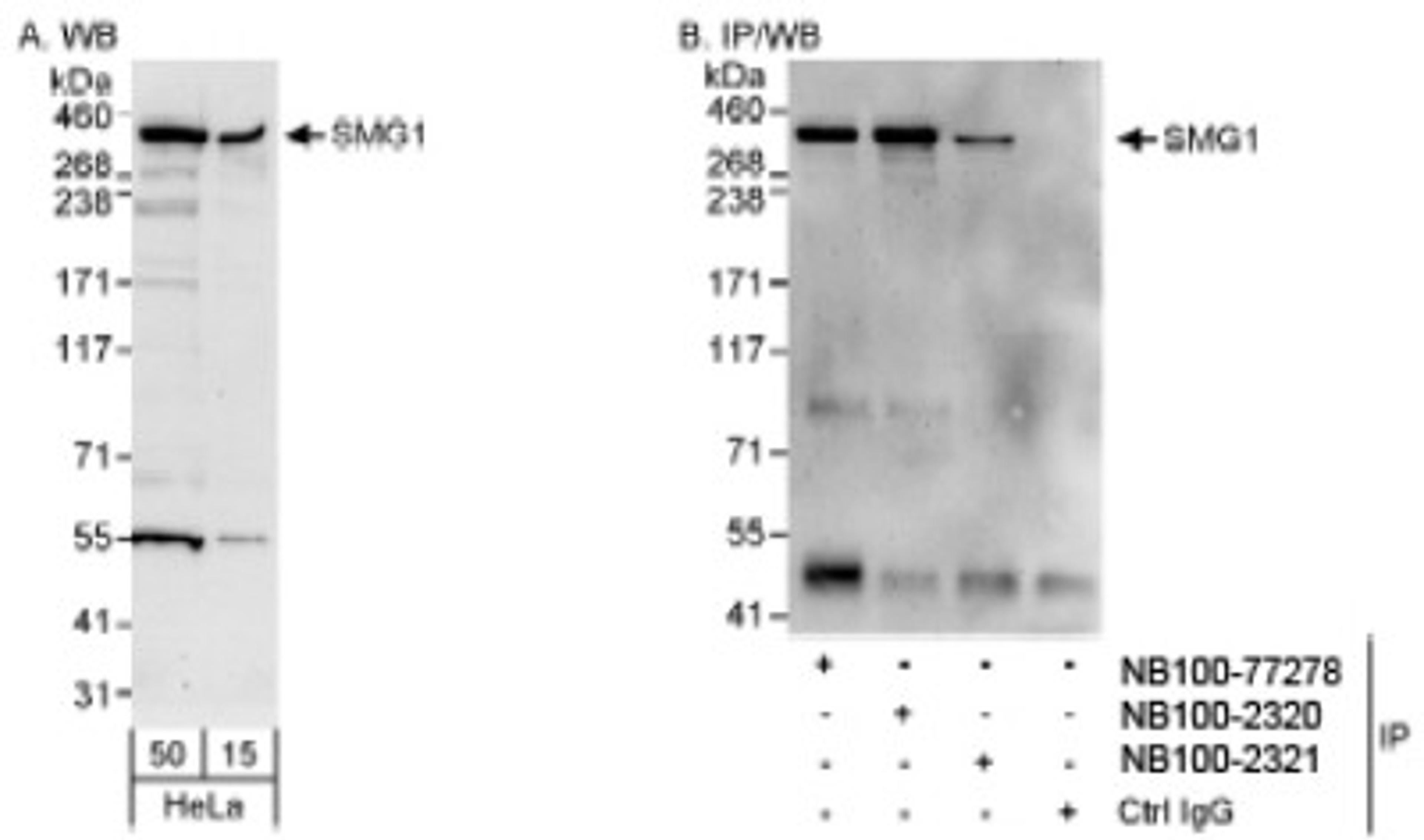 Western Blot: SMG1 Antibody [NB100-77278] - HeLa whole cell lysate using NB100-77278. SMG1 was also immunoprecipitated by rabbit anti-SMG1 antibodies NB100-2320 and NB100-2321.