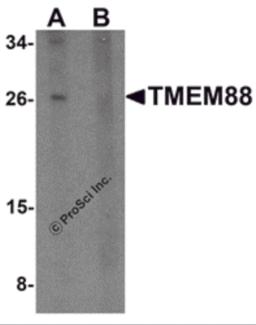 Western blot analysis of TMEM88 in human brain tissue lysate with TMEM88 antibody at 1 &#956;g/mL in (A) the absence and (B) the presence of blocking peptide.