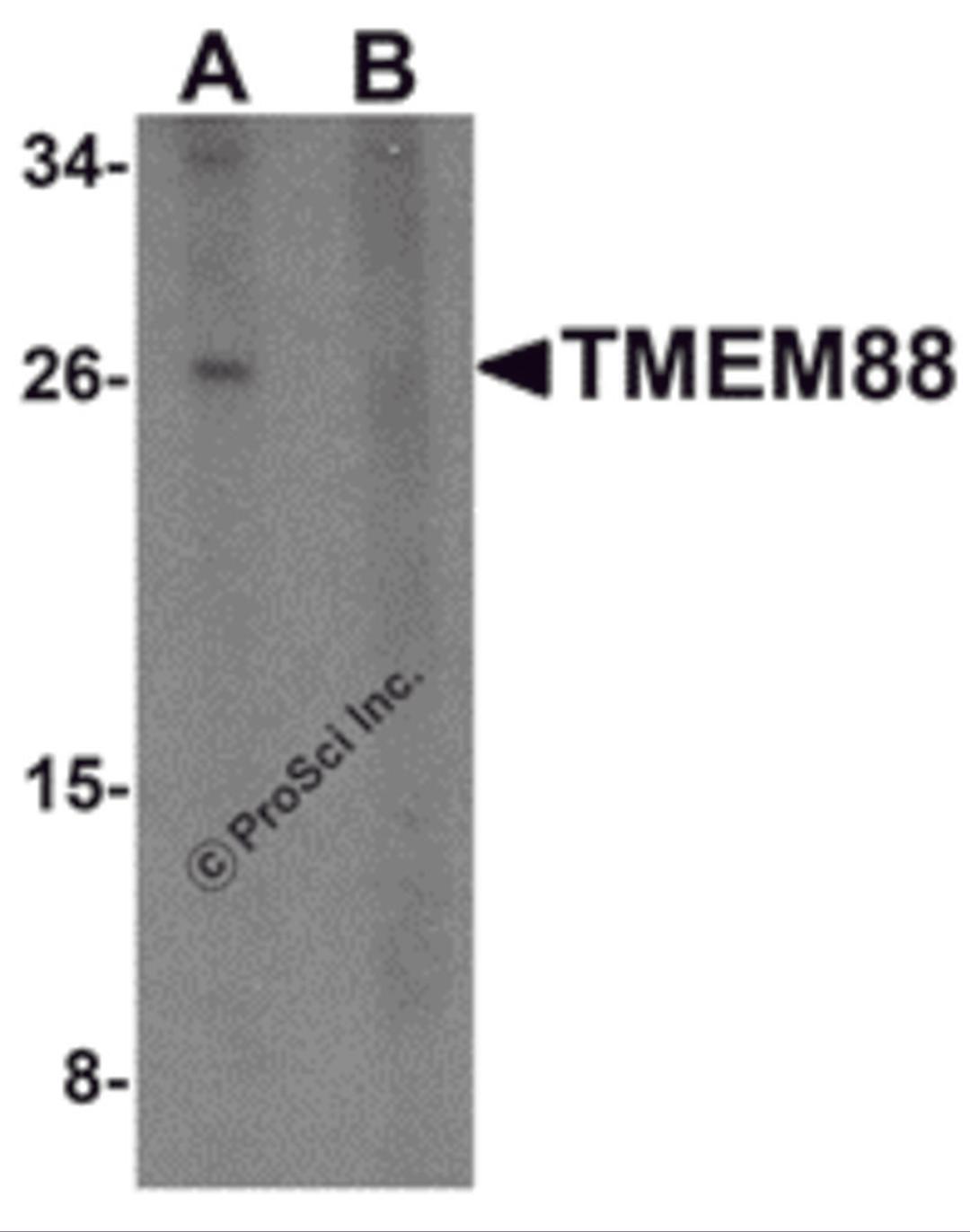 Western blot analysis of TMEM88 in human brain tissue lysate with TMEM88 antibody at 1 μg/mL in (A) the absence and (B) the presence of blocking peptide.