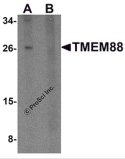 Western blot analysis of TMEM88 in human brain tissue lysate with TMEM88 antibody at 1 μg/mL in (A) the absence and (B) the presence of blocking peptide.