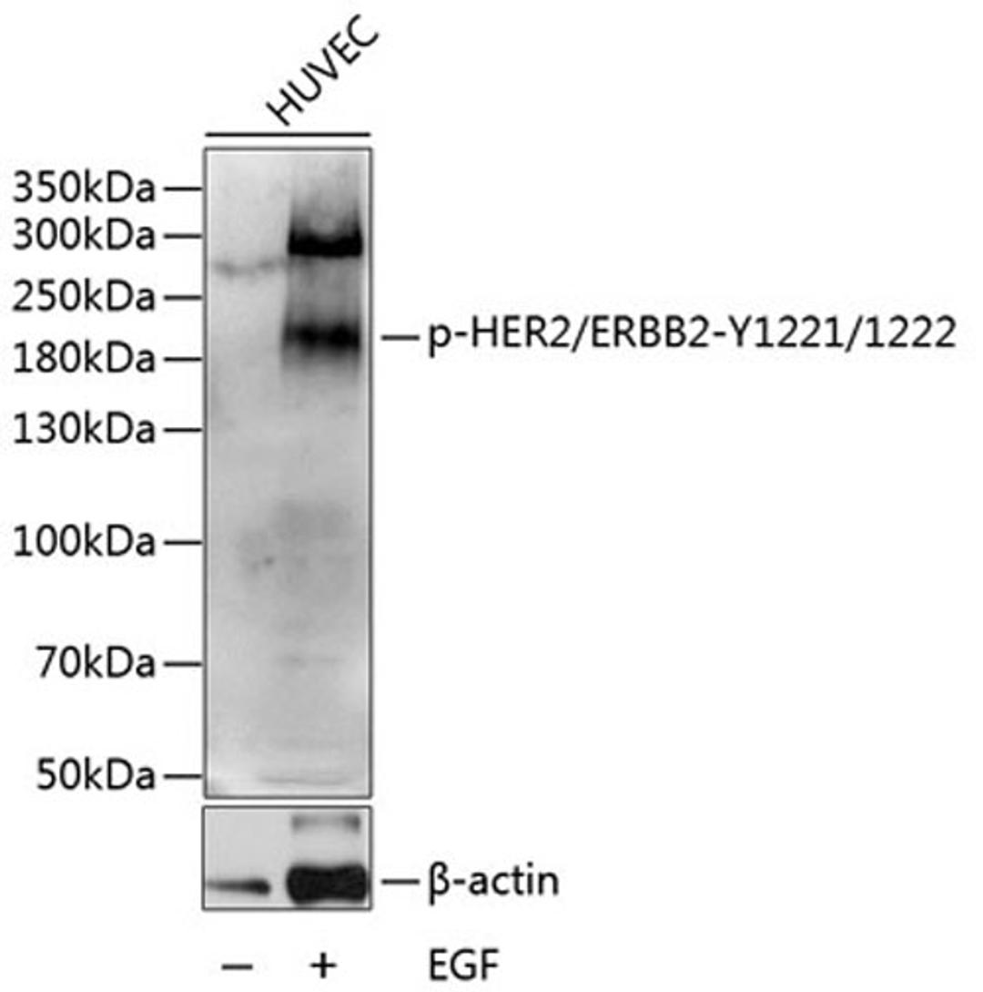 Western blot - Phospho-HER2/ERBB2-Y1221/1222 antibody (AP0527)