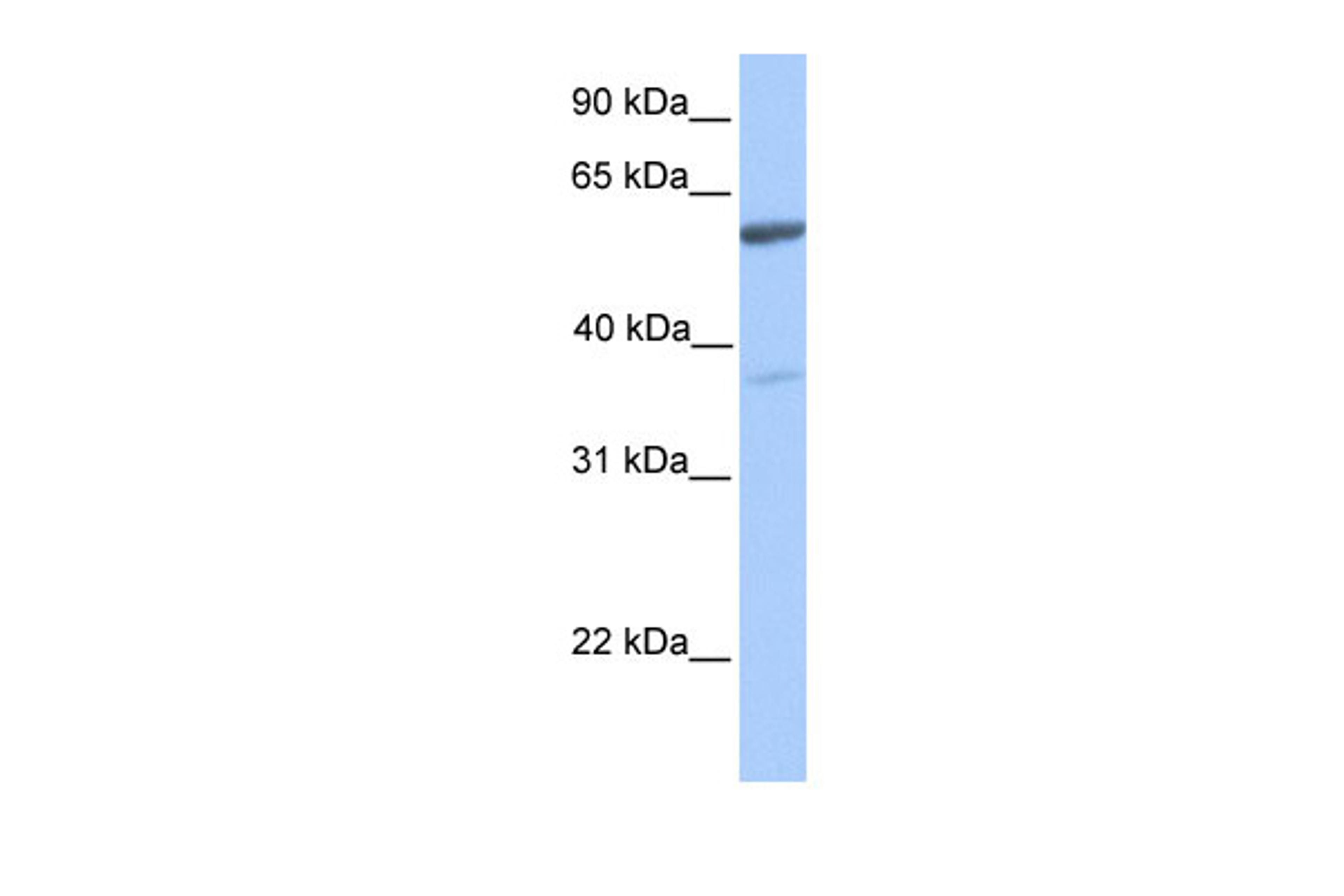 Antibody used in WB on Human Heart at 0.2-1 ug/ml.