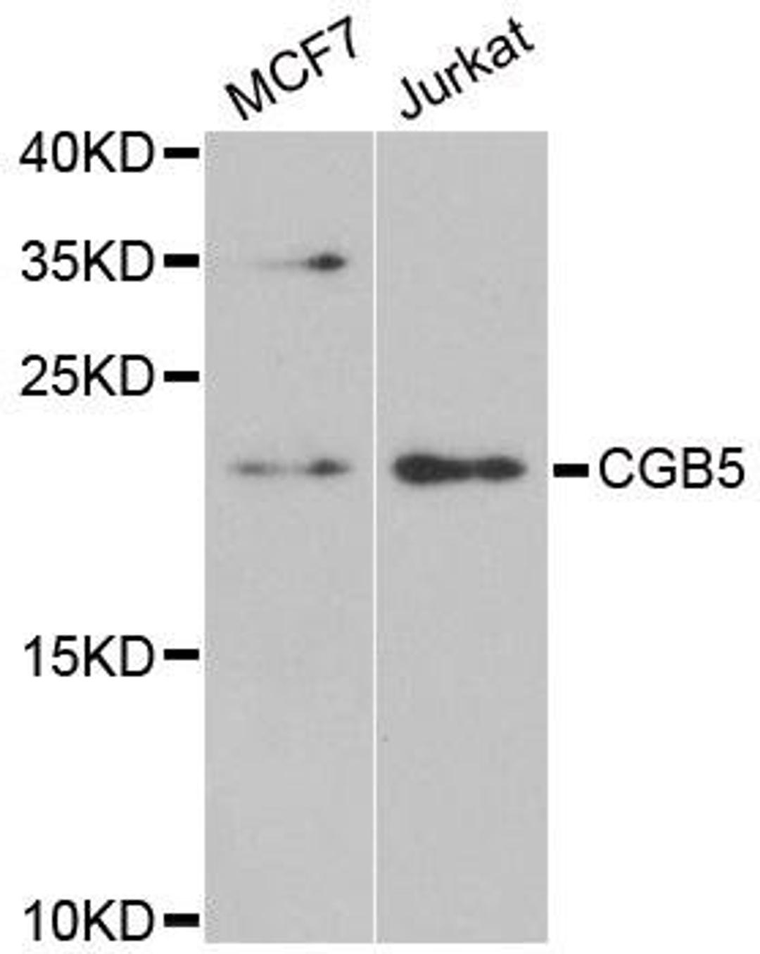 Western blot analysis of extracts of various cell lines using CGB5 antibody