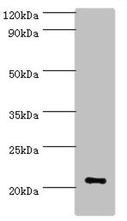 Western blot. All lanes: ARF3 antibody at 6ug/ml + Mouse brain tissue. Secondary. Goat polyclonal to rabbit IgG at 1/10000 dilution. Predicted band size: 21, 17 kDa. Observed band size: 21 kDa. 