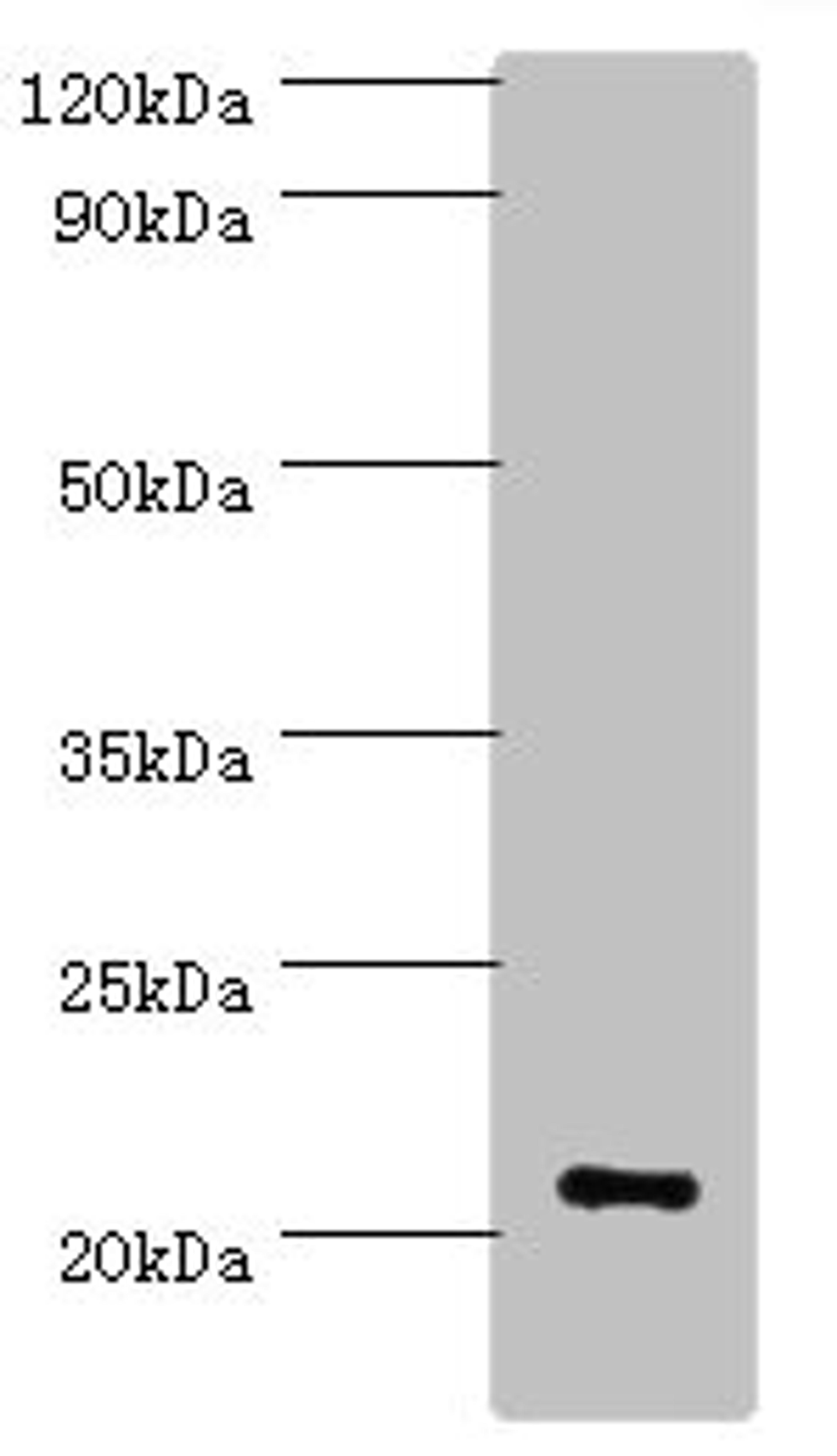 Western blot. All lanes: ARF3 antibody at 6ug/ml + Mouse brain tissue. Secondary. Goat polyclonal to rabbit IgG at 1/10000 dilution. Predicted band size: 21, 17 kDa. Observed band size: 21 kDa. 