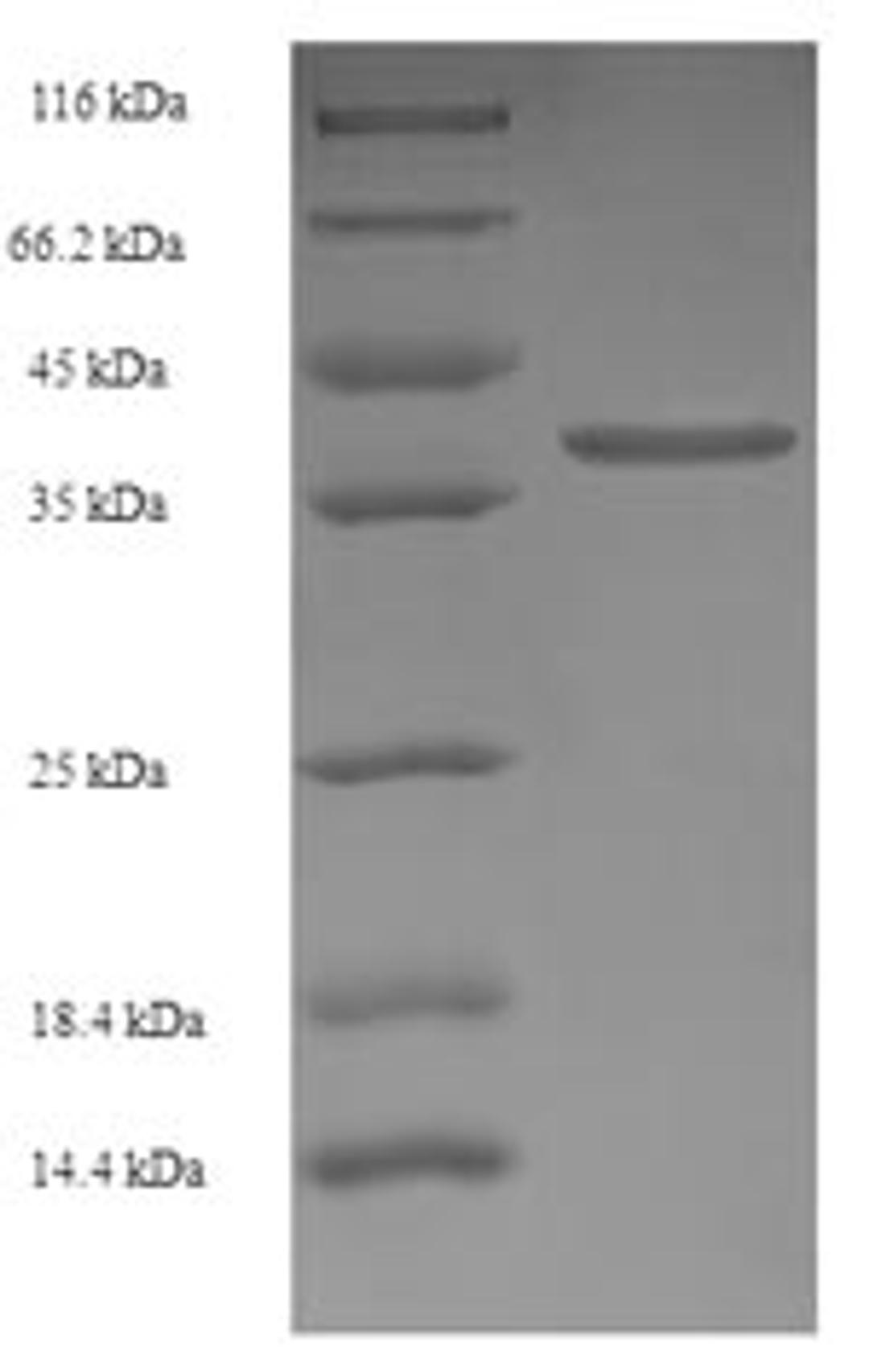(Tris-Glycine gel) Discontinuous SDS-PAGE (reduced) with 5% enrichment gel and 15% separation gel.