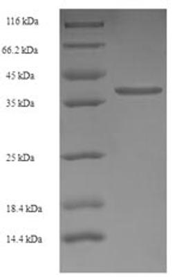 (Tris-Glycine gel) Discontinuous SDS-PAGE (reduced) with 5% enrichment gel and 15% separation gel.