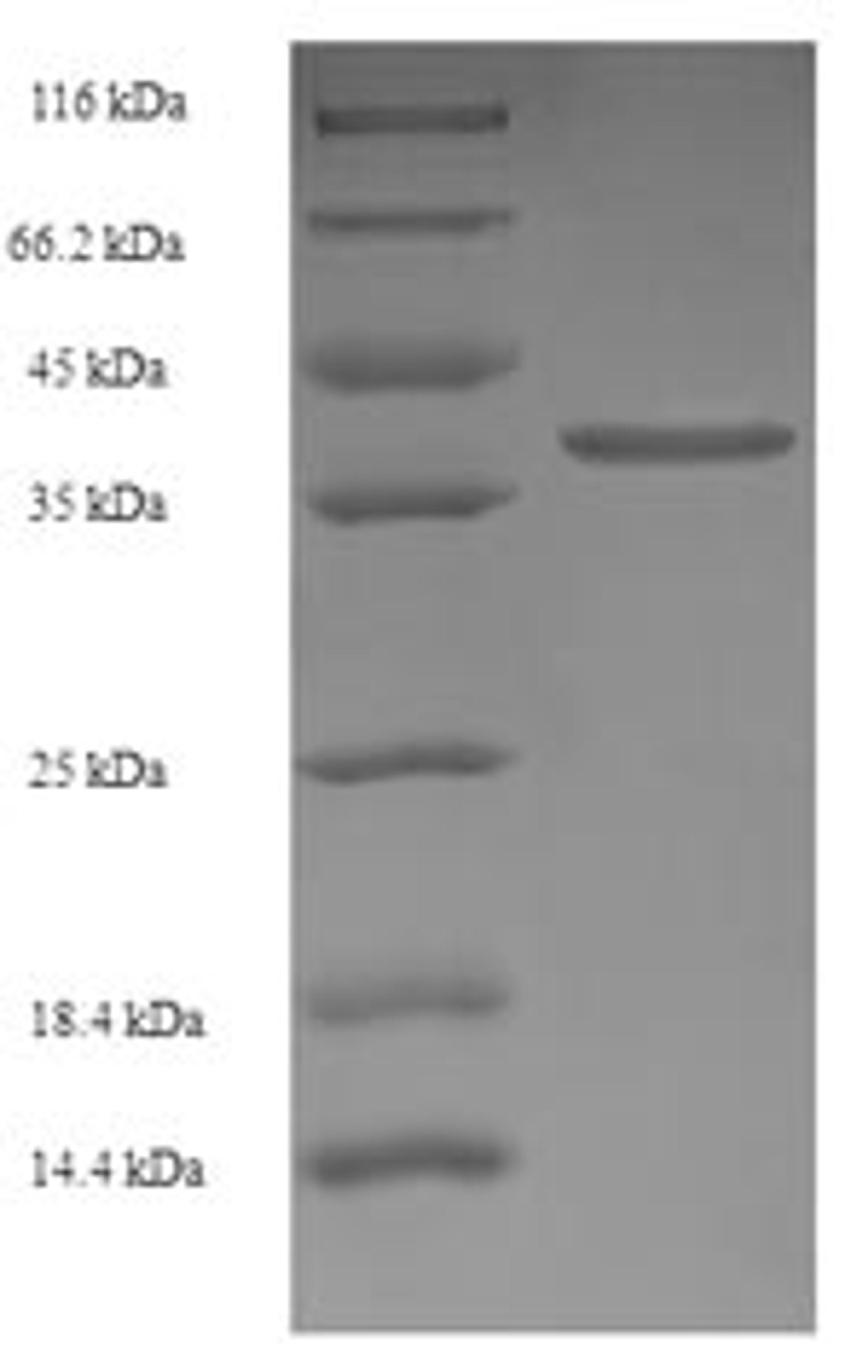 (Tris-Glycine gel) Discontinuous SDS-PAGE (reduced) with 5% enrichment gel and 15% separation gel.
