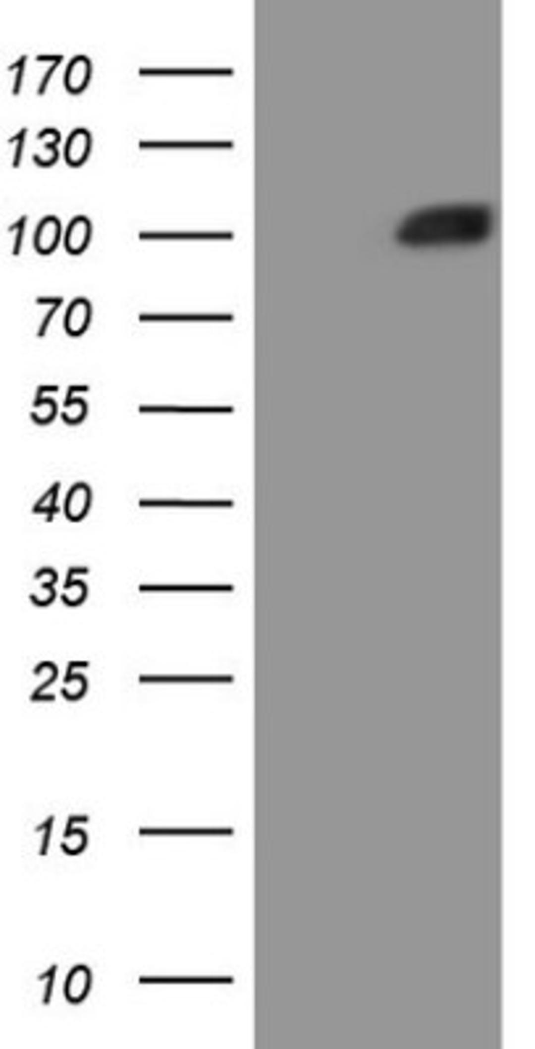 Western Blot: MSP/MST1 Antibody (1A10) [NBP2-46024] - Analysis of HEK293T cells were transfected with the pCMV6-ENTRY control (Left lane) or pCMV6-ENTRY MST1.