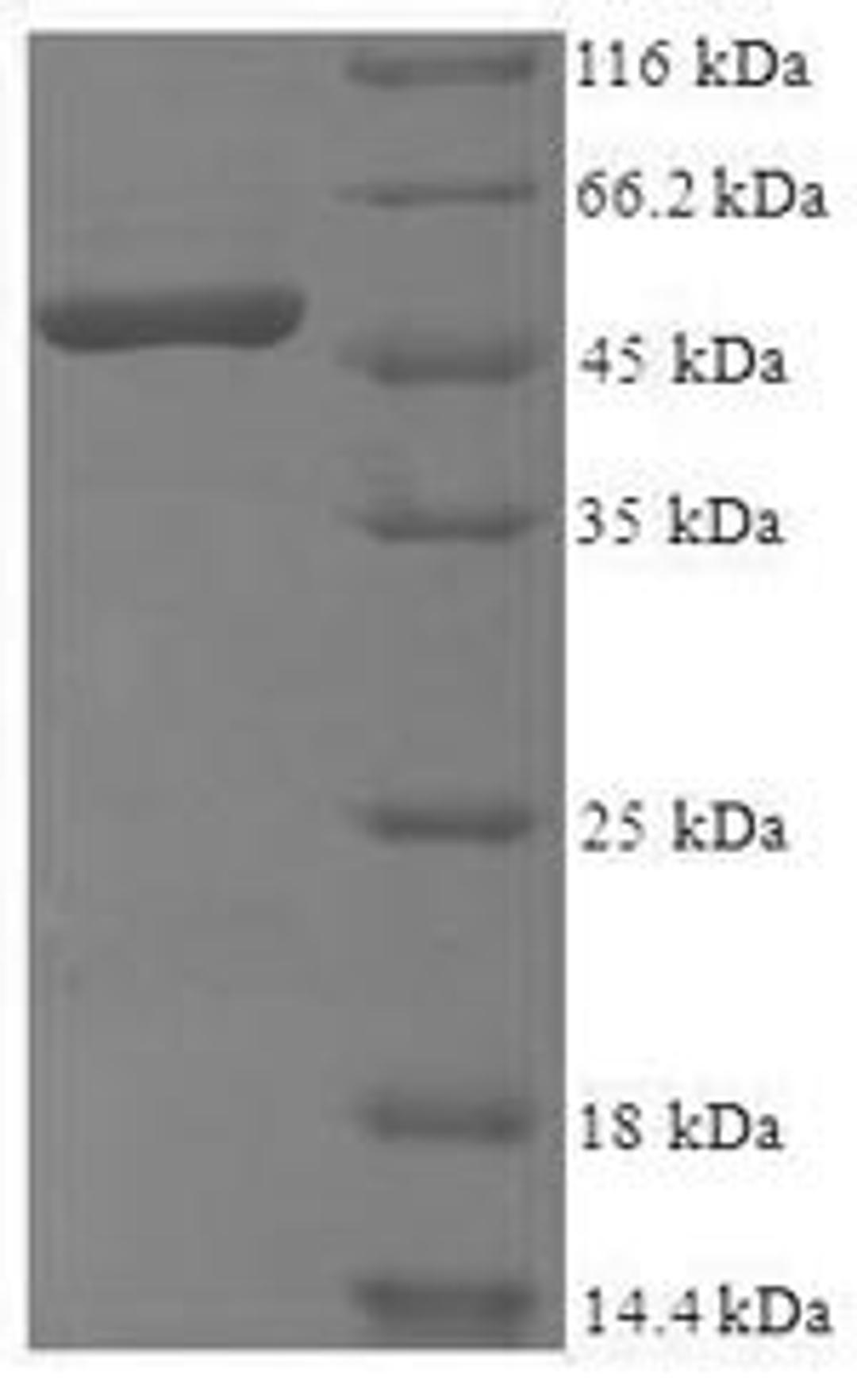 (Tris-Glycine gel) Discontinuous SDS-PAGE (reduced) with 5% enrichment gel and 15% separation gel.