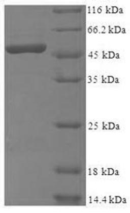 (Tris-Glycine gel) Discontinuous SDS-PAGE (reduced) with 5% enrichment gel and 15% separation gel.